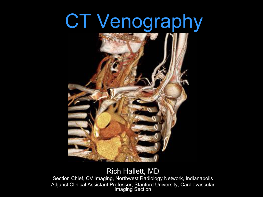 CT Venography