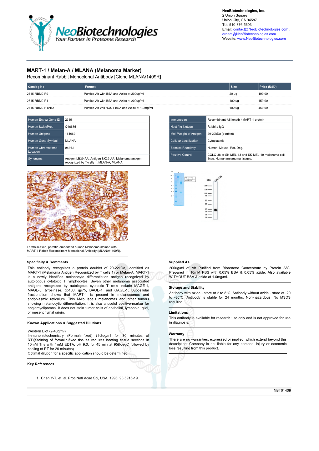 MART-1 / Melan-A / MLANA (Melanoma Marker) Recombinant Rabbit Monoclonal Antibody [Clone MLANA/1409R]