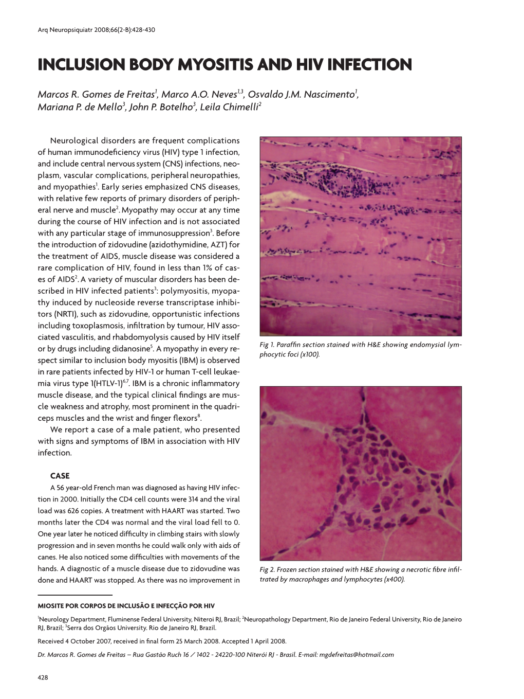 Inclusion Body Myositis and HIV Infection