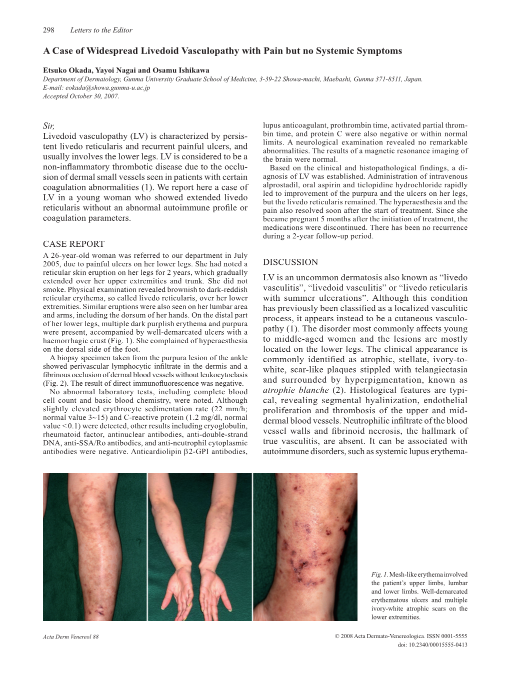 A Case of Widespread Livedoid Vasculopathy with Pain but No Systemic Symptoms