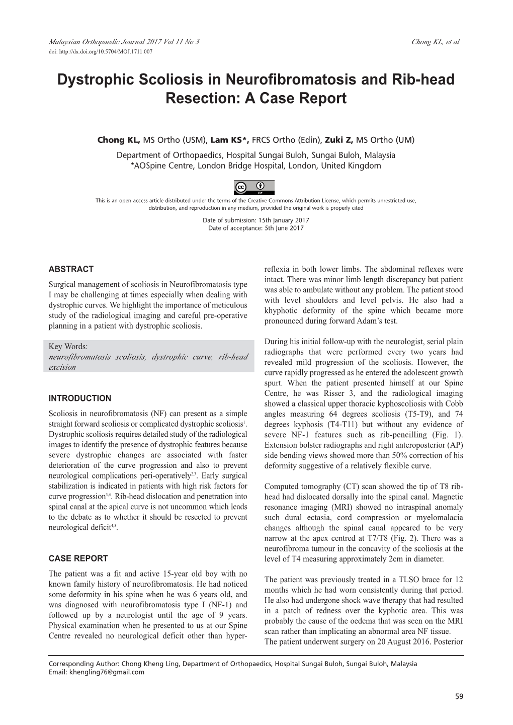 Dystrophic Scoliosis in Neurofibromatosis and Rib-Head Resection: a Case Report