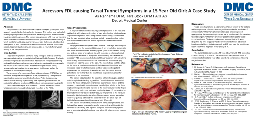 Accessory FDL Causing Tarsal Tunnel Symptoms in a 15 Year