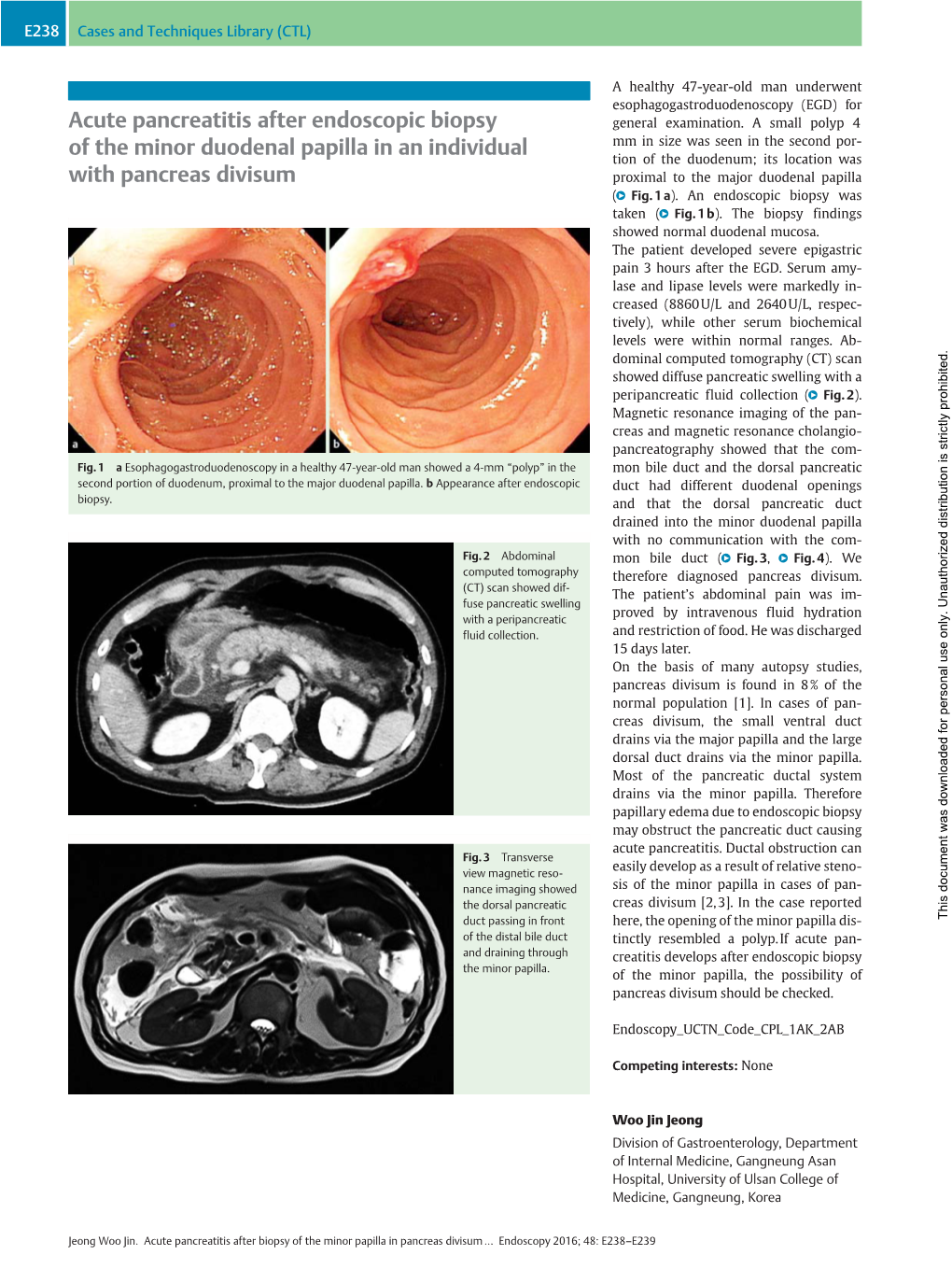 Acute Pancreatitis After Endoscopic Biopsy of the Minor Duodenal
