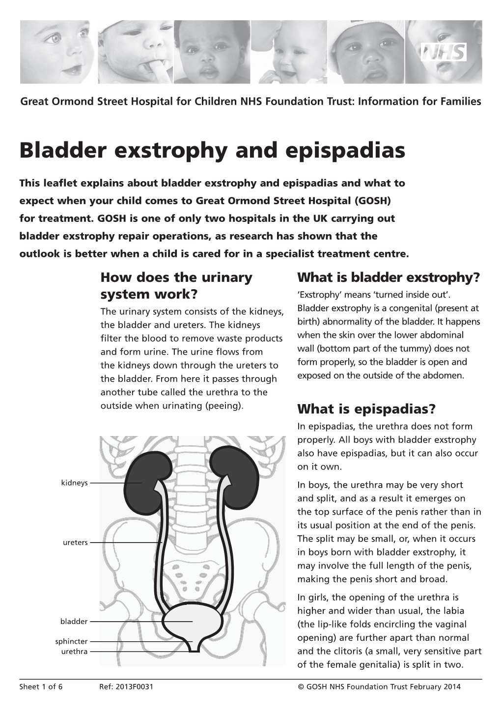 Bladder Exstrophy and Epispadias