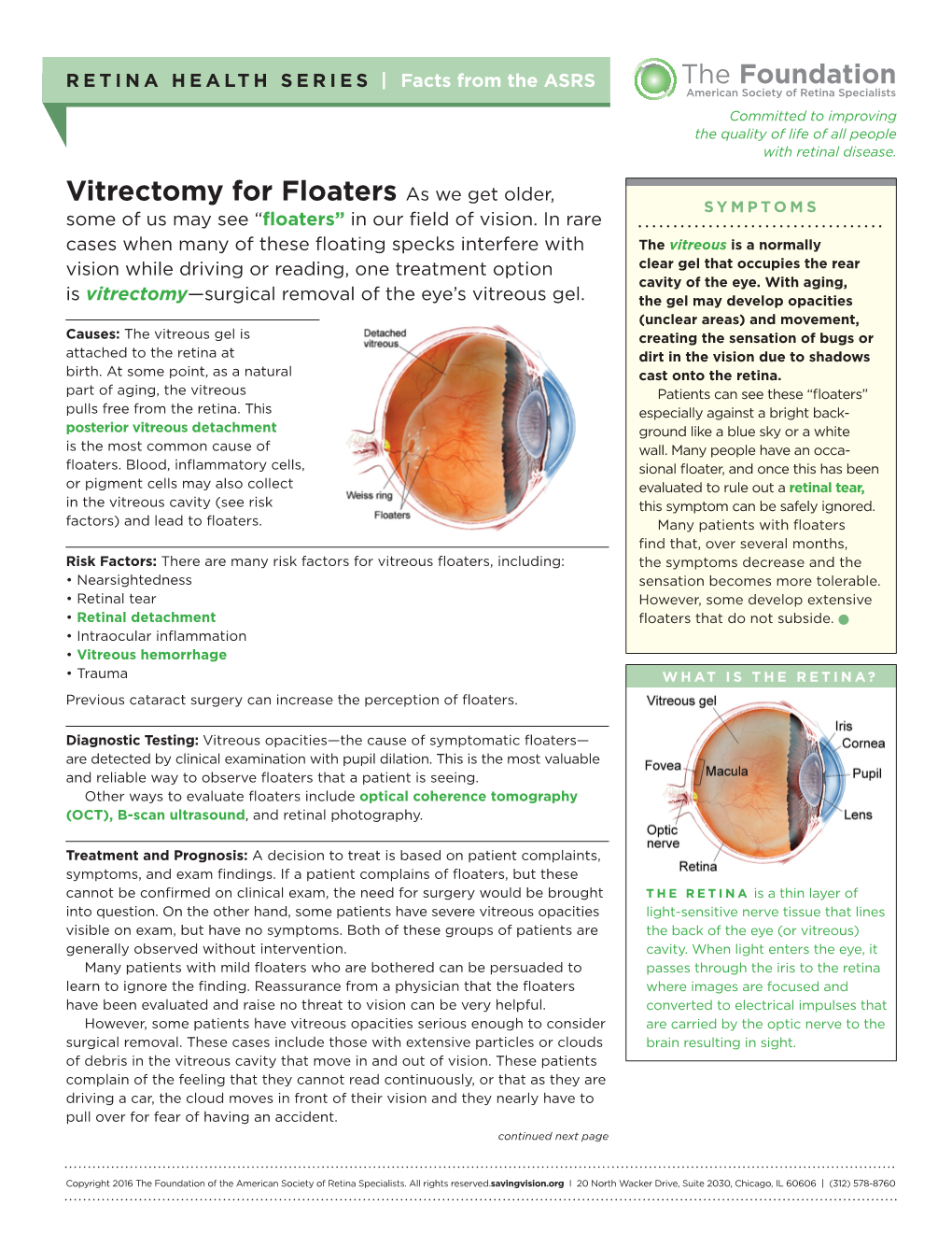 Vitrectomy for Floaters As We Get Older, SYMPTOMS Some of Us May See “Floaters” in Our Field of Vision