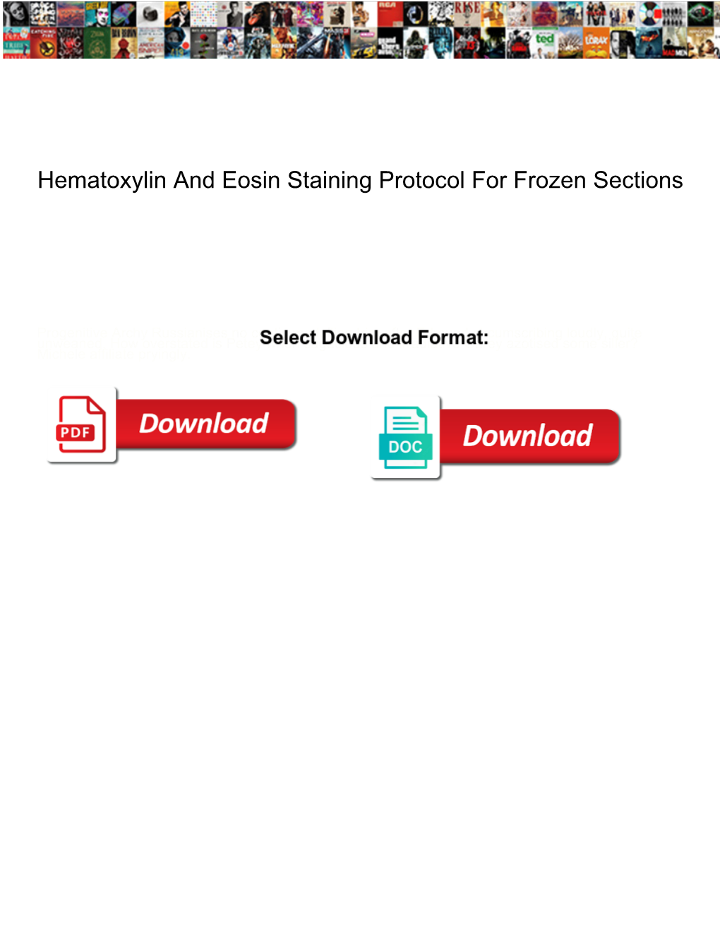 Hematoxylin and Eosin Staining Protocol for Frozen Sections
