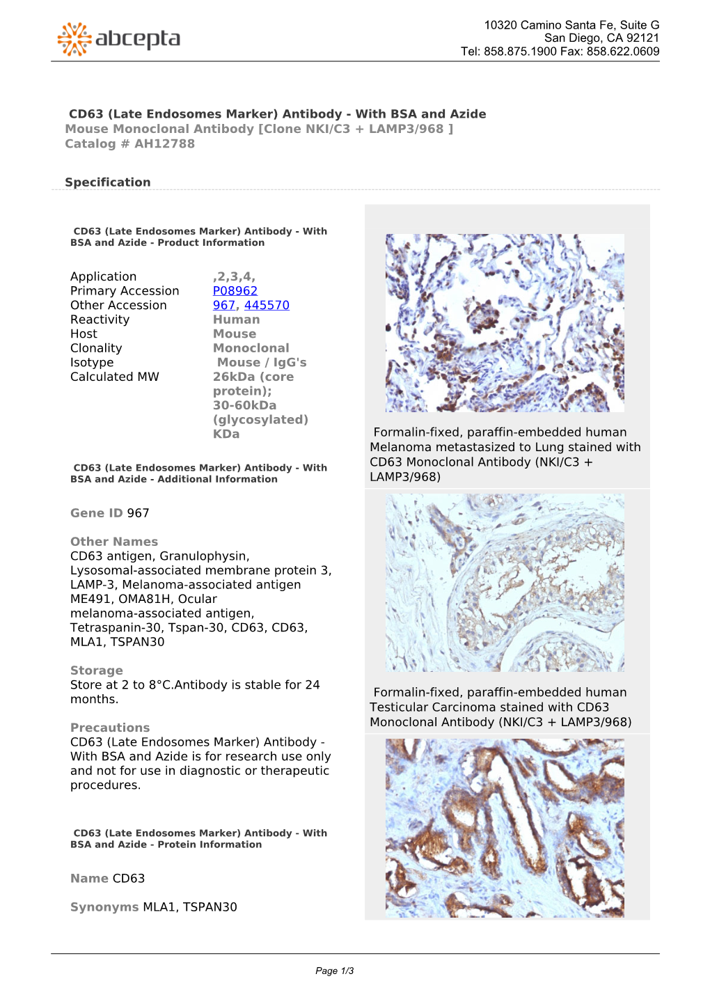 CD63 (Late Endosomes Marker) Antibody - with BSA and Azide Mouse Monoclonal Antibody [Clone NKI/C3 + LAMP3/968 ] Catalog # AH12788