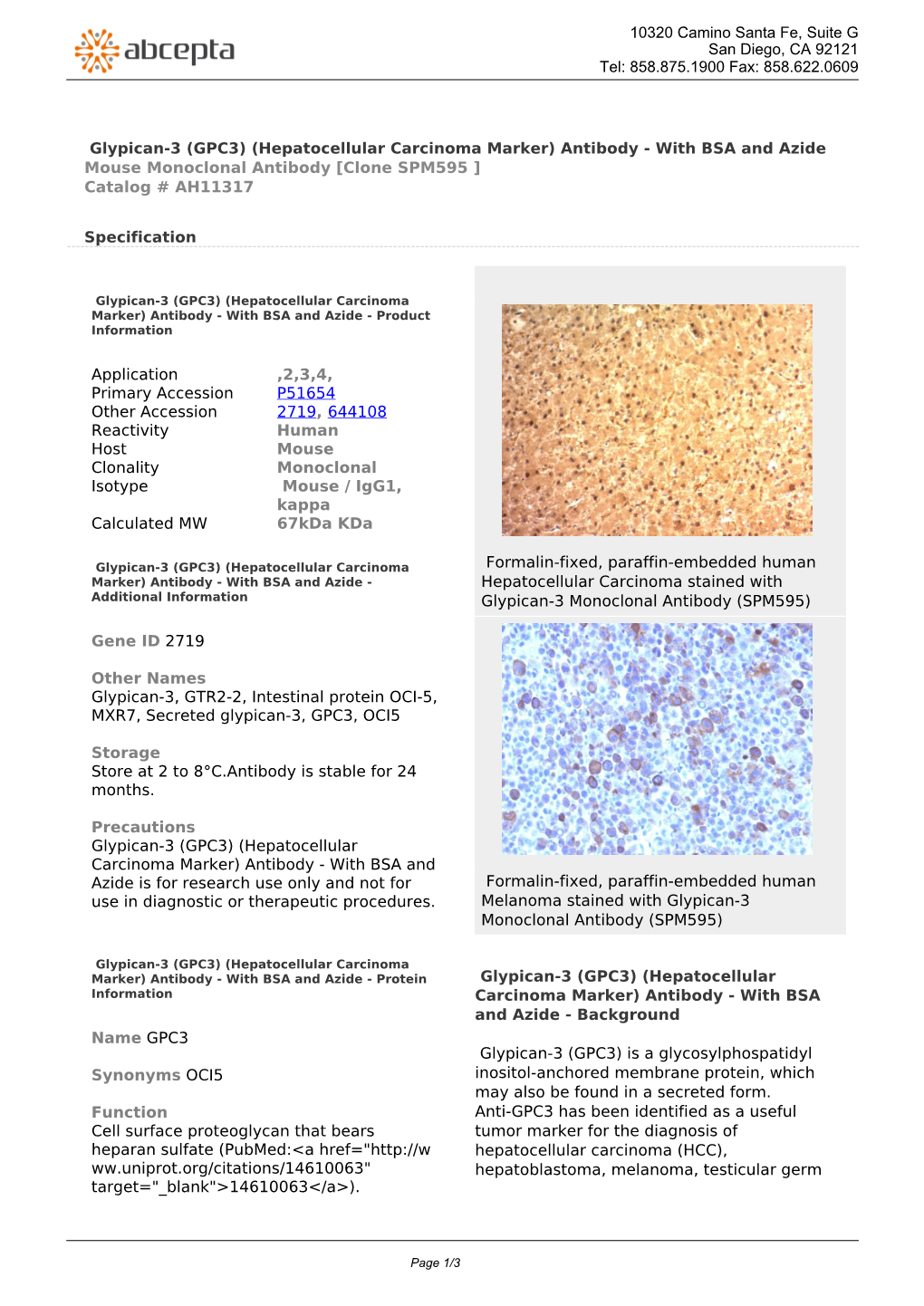 (GPC3) (Hepatocellular Carcinoma Marker) Antibody - with BSA and Azide Mouse Monoclonal Antibody [Clone SPM595 ] Catalog # AH11317