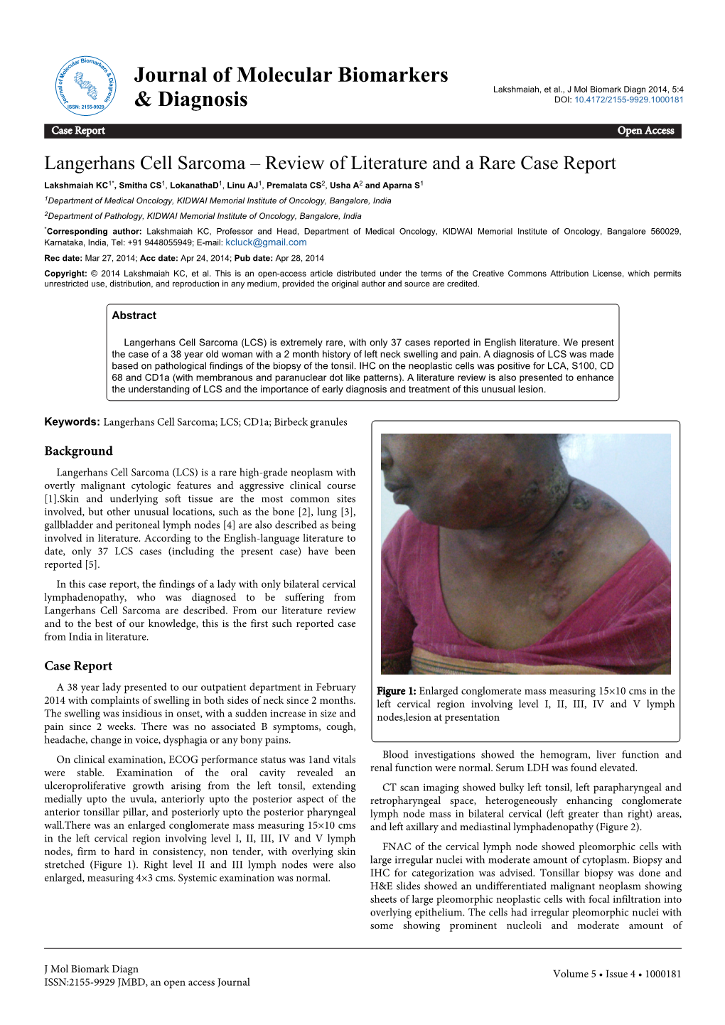 Langerhans Cell Sarcoma – Review of Literature and a Rare Case Report