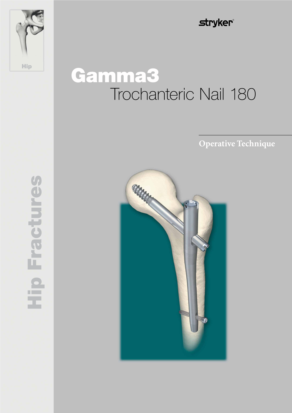 Operative Technique Operative Technique Hip Fractures Trochanteric Nail 180