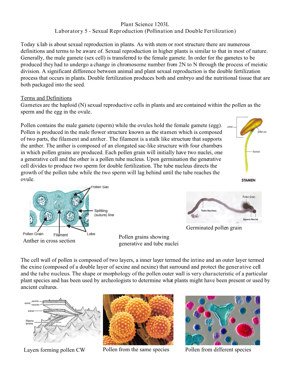 Anther in Cross Section Pollen Grains Showing Generative and Tube Nuclei