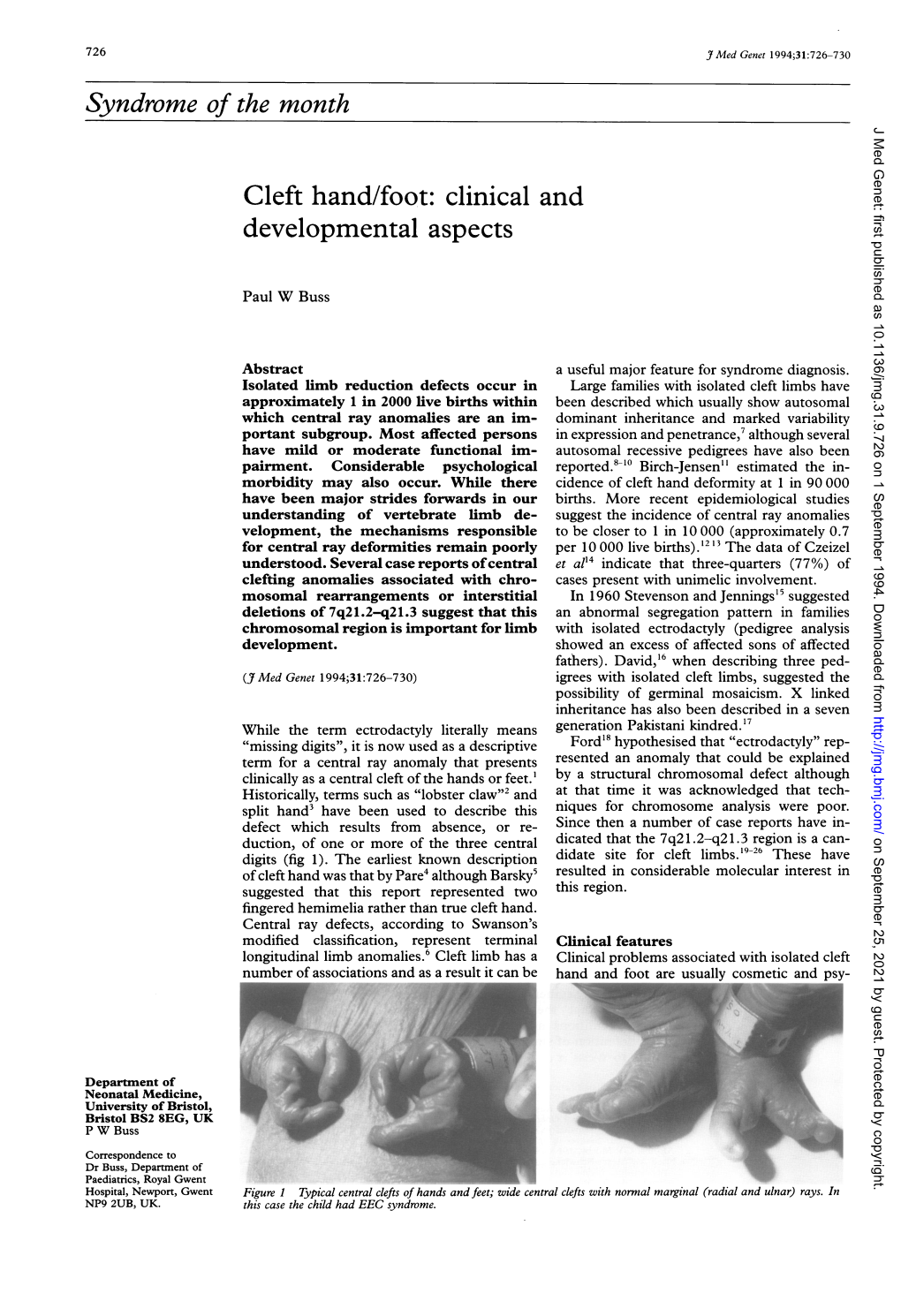 Syndrome of the Month Cleft Hand/Foot