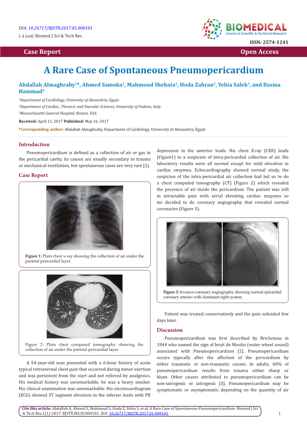 A Rare Case of Spontaneous Pneumopericardium'