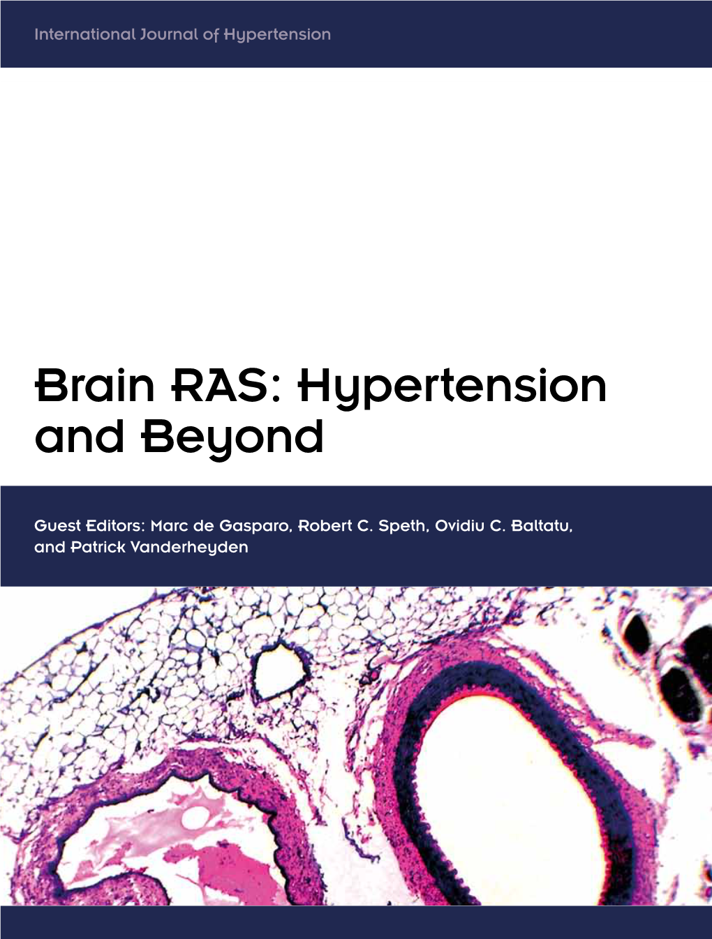 Brain RAS: Hypertension and Beyond