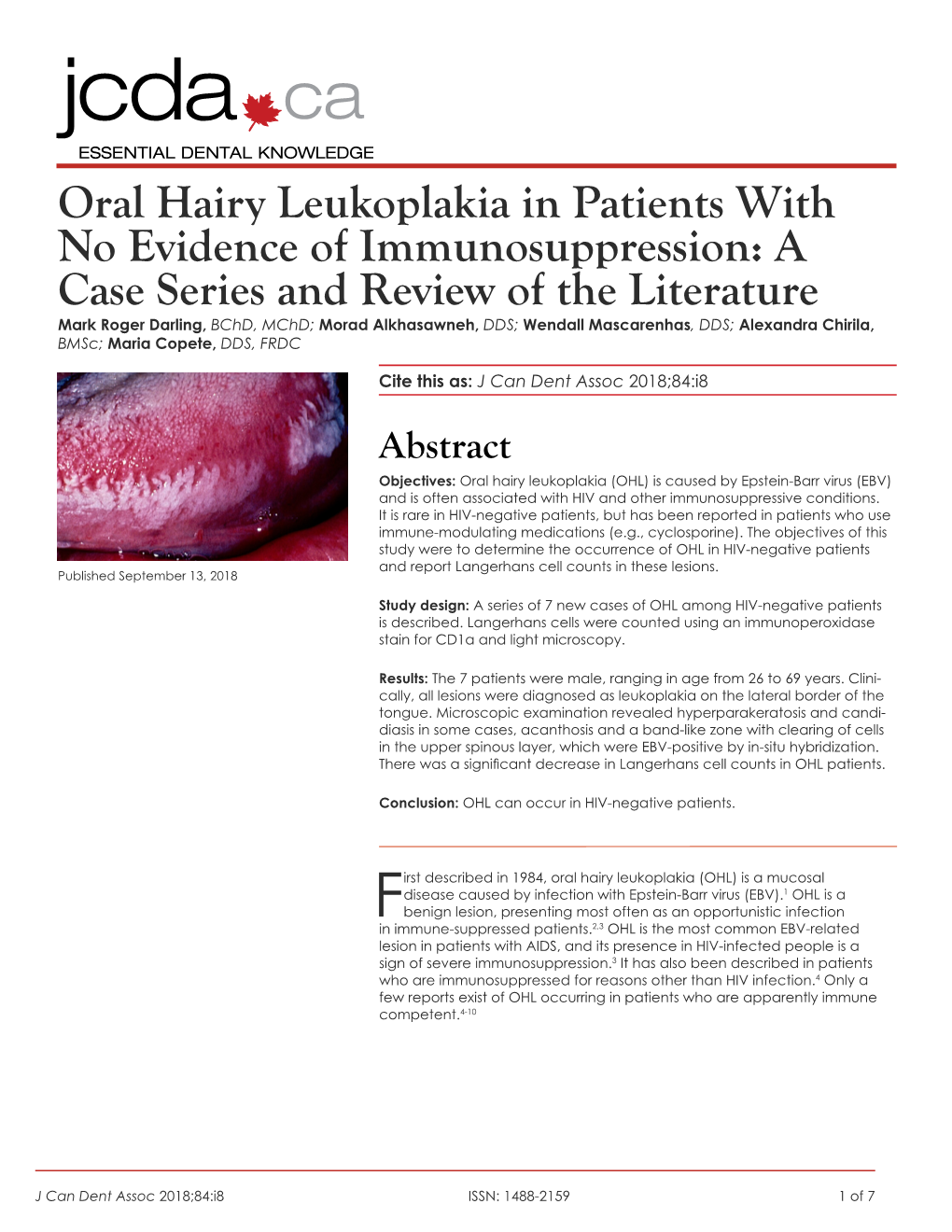 Oral Hairy Leukoplakia in Patients with No Evidence Of