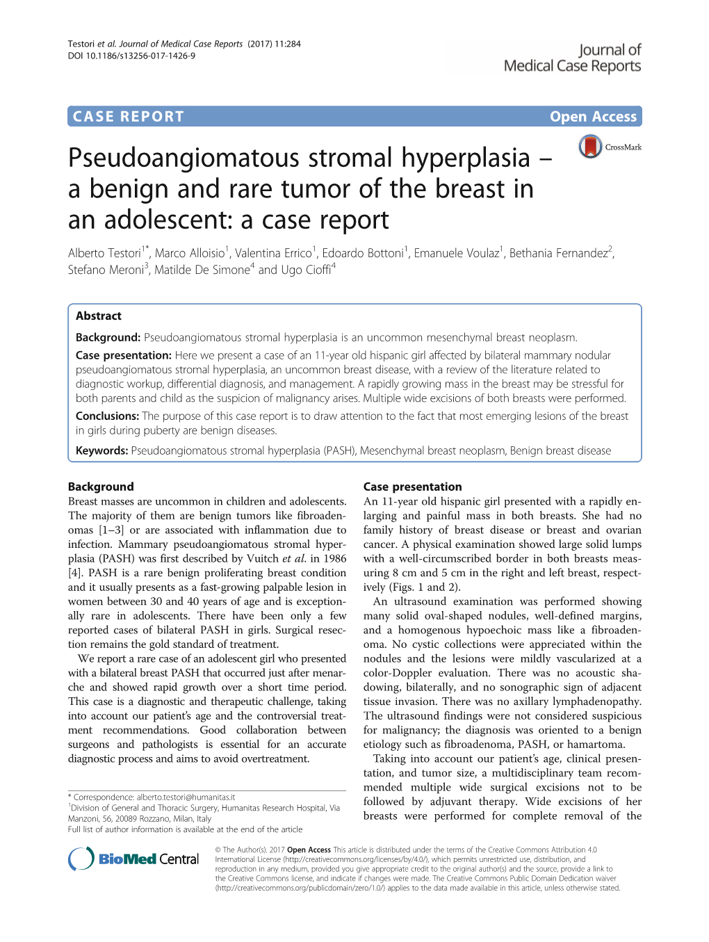 Pseudoangiomatous Stromal Hyperplasia