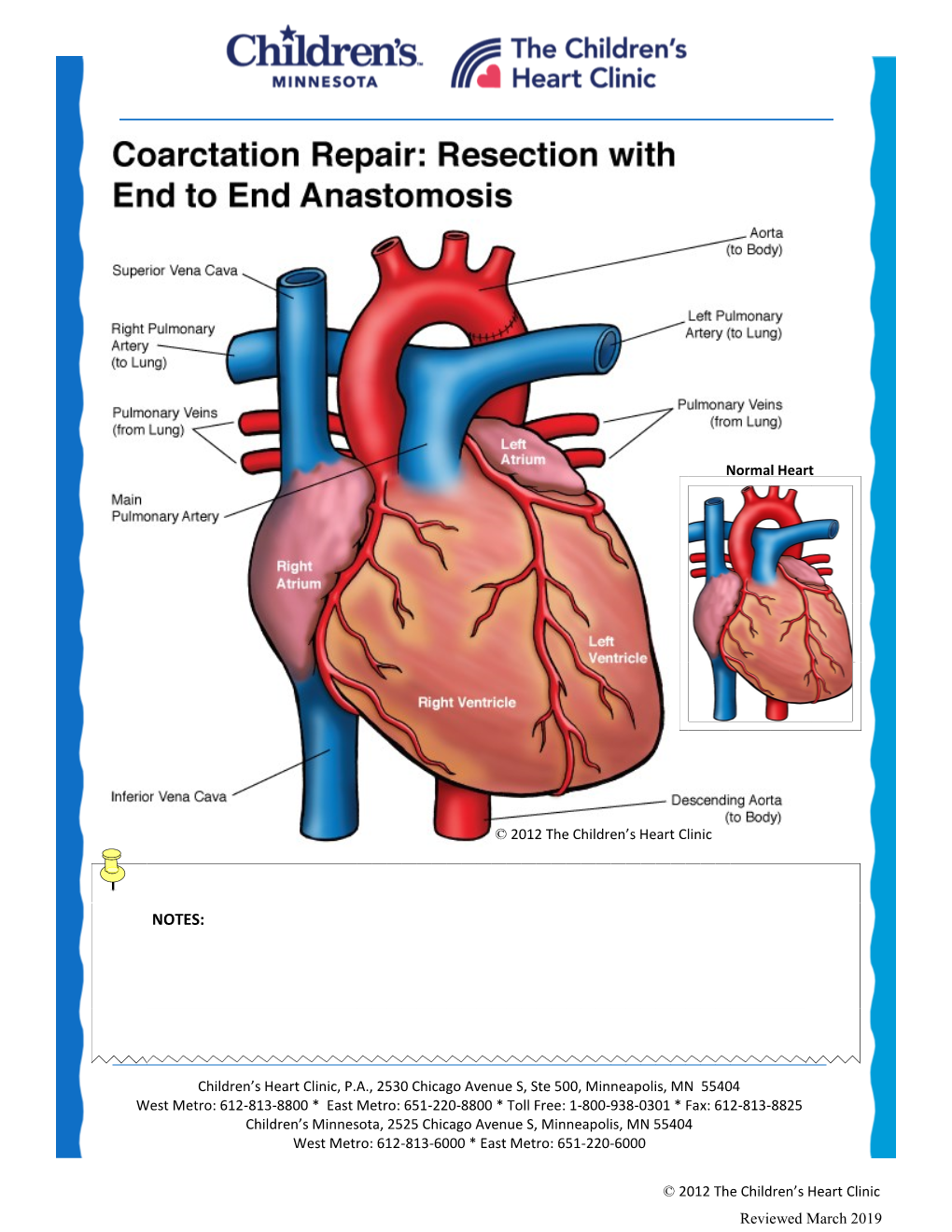 Coarctation of the Aorta Repair