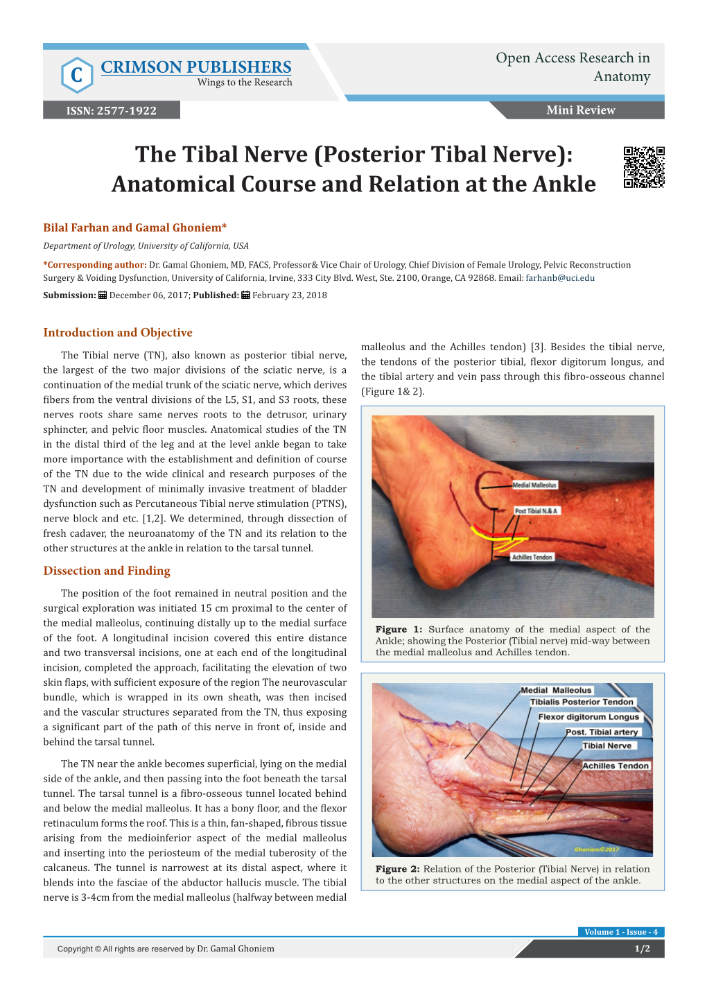 The Tibal Nerve (Posterior Tibal Nerve): Anatomical Course and Relation at the Ankle