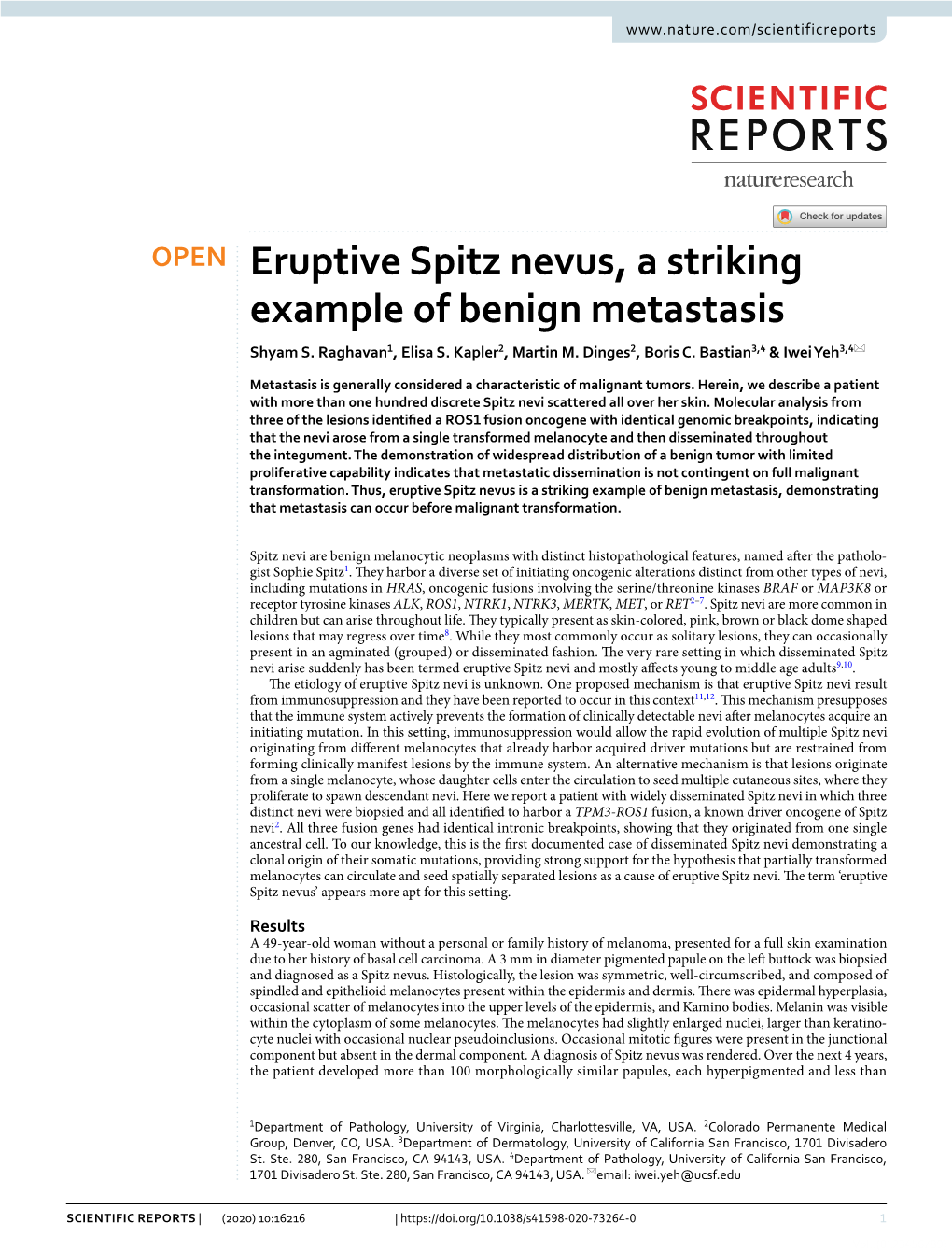 Eruptive Spitz Nevus, a Striking Example of Benign Metastasis Shyam S