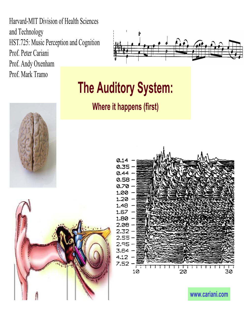 The Auditory System: Where It Happens (First)
