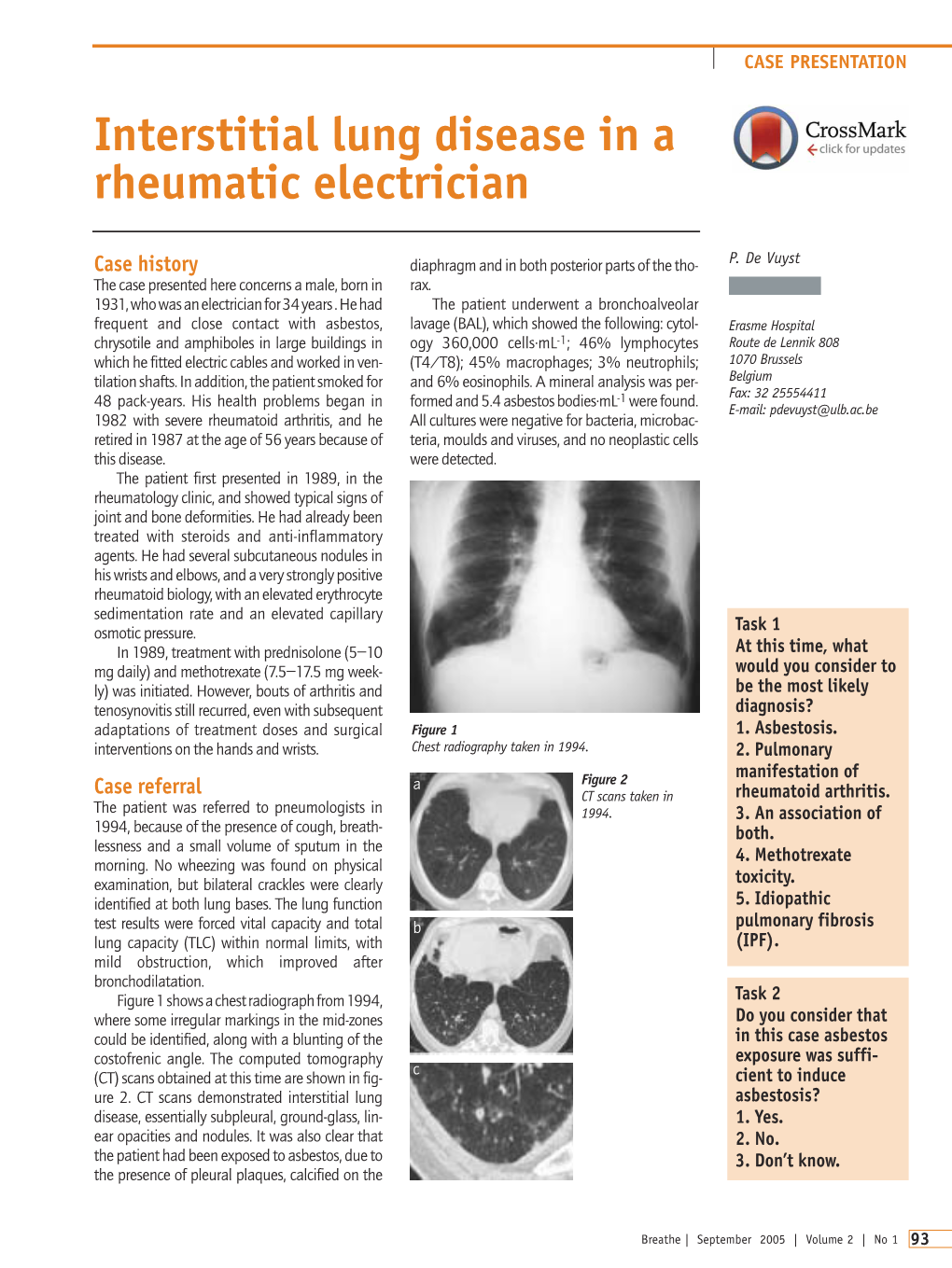 Interstitial Lung Disease in a Rheumatic Electrician