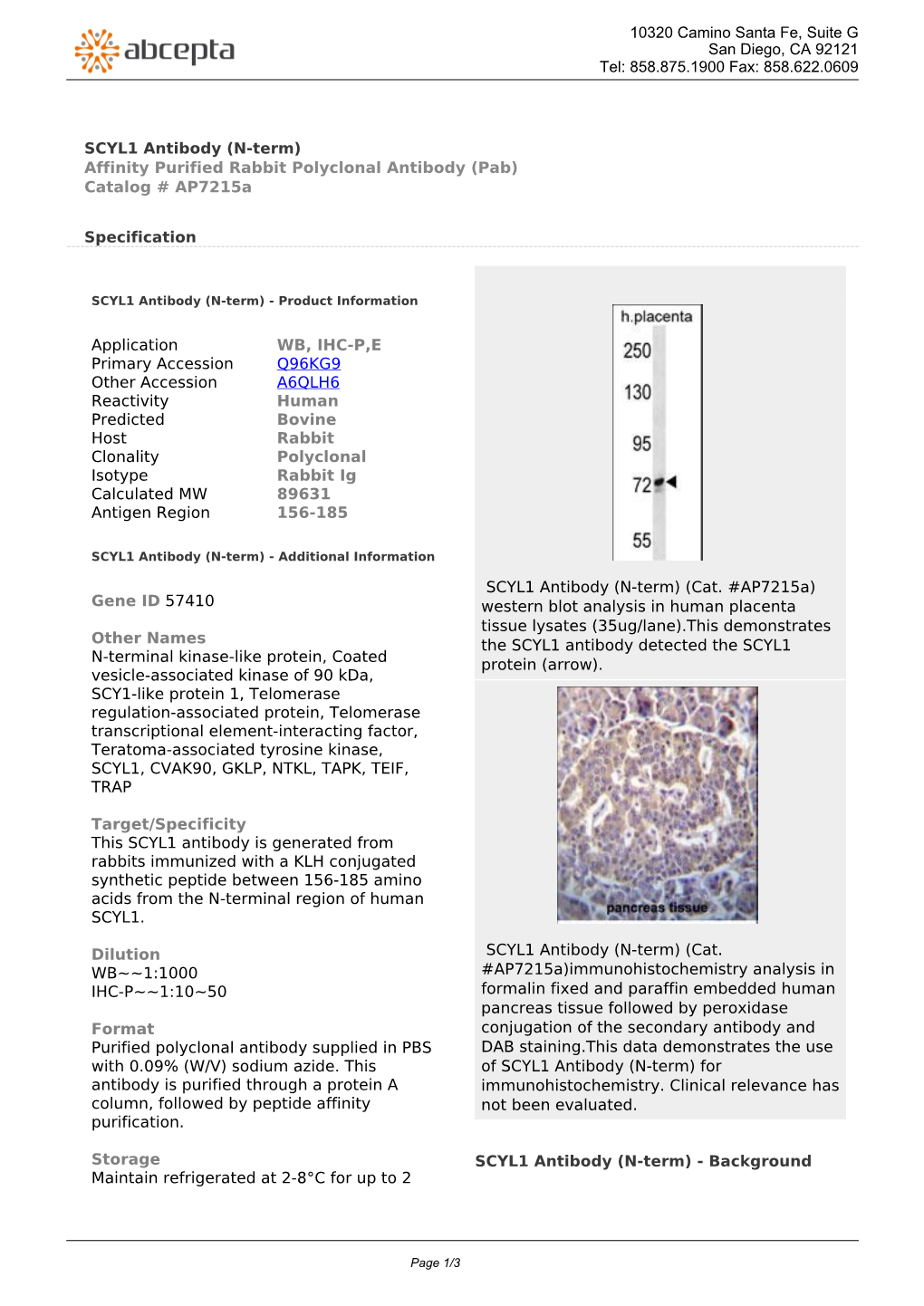 SCYL1 Antibody (N-Term) Affinity Purified Rabbit Polyclonal Antibody (Pab) Catalog # Ap7215a