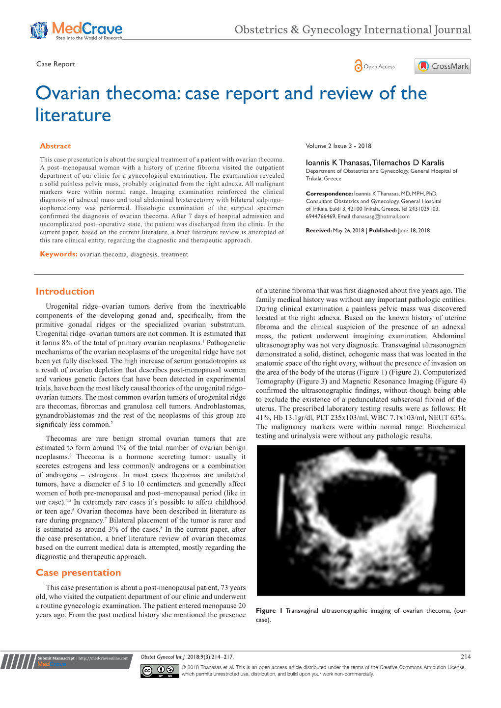 Ovarian Thecoma: Case Report and Review of the Literature