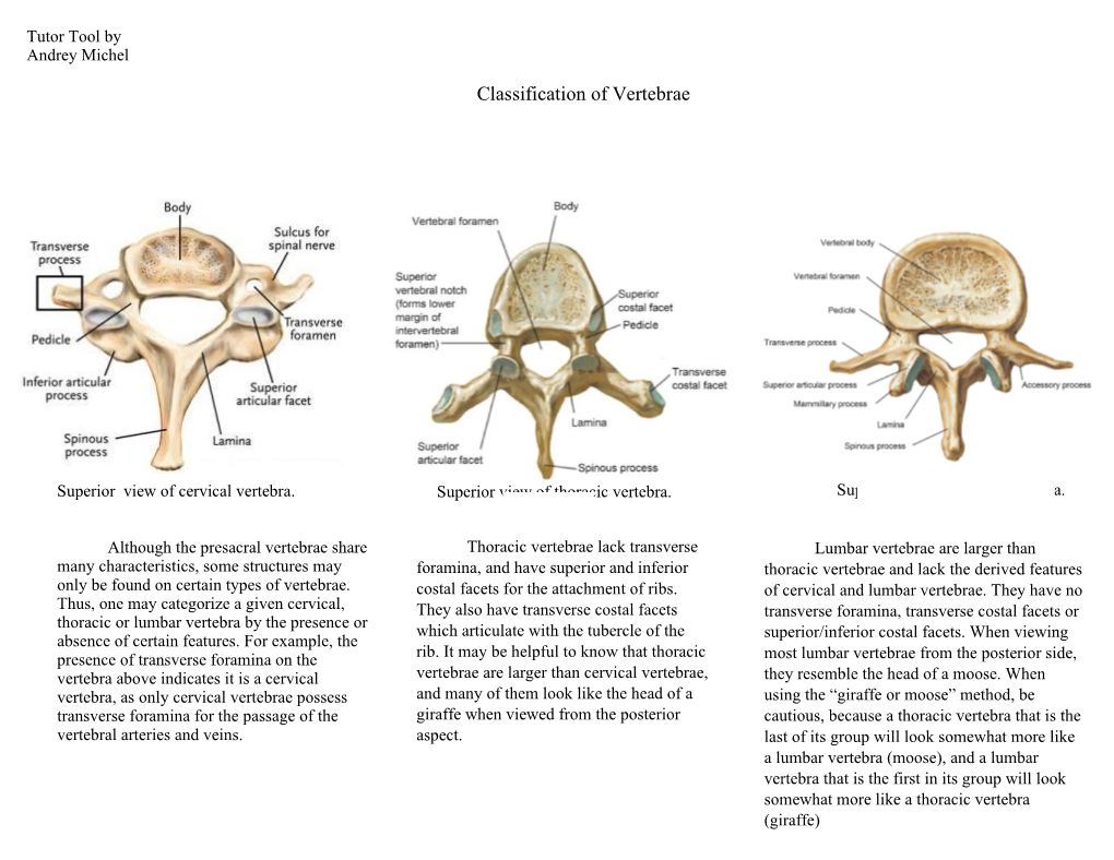 Classification of Vertebrae