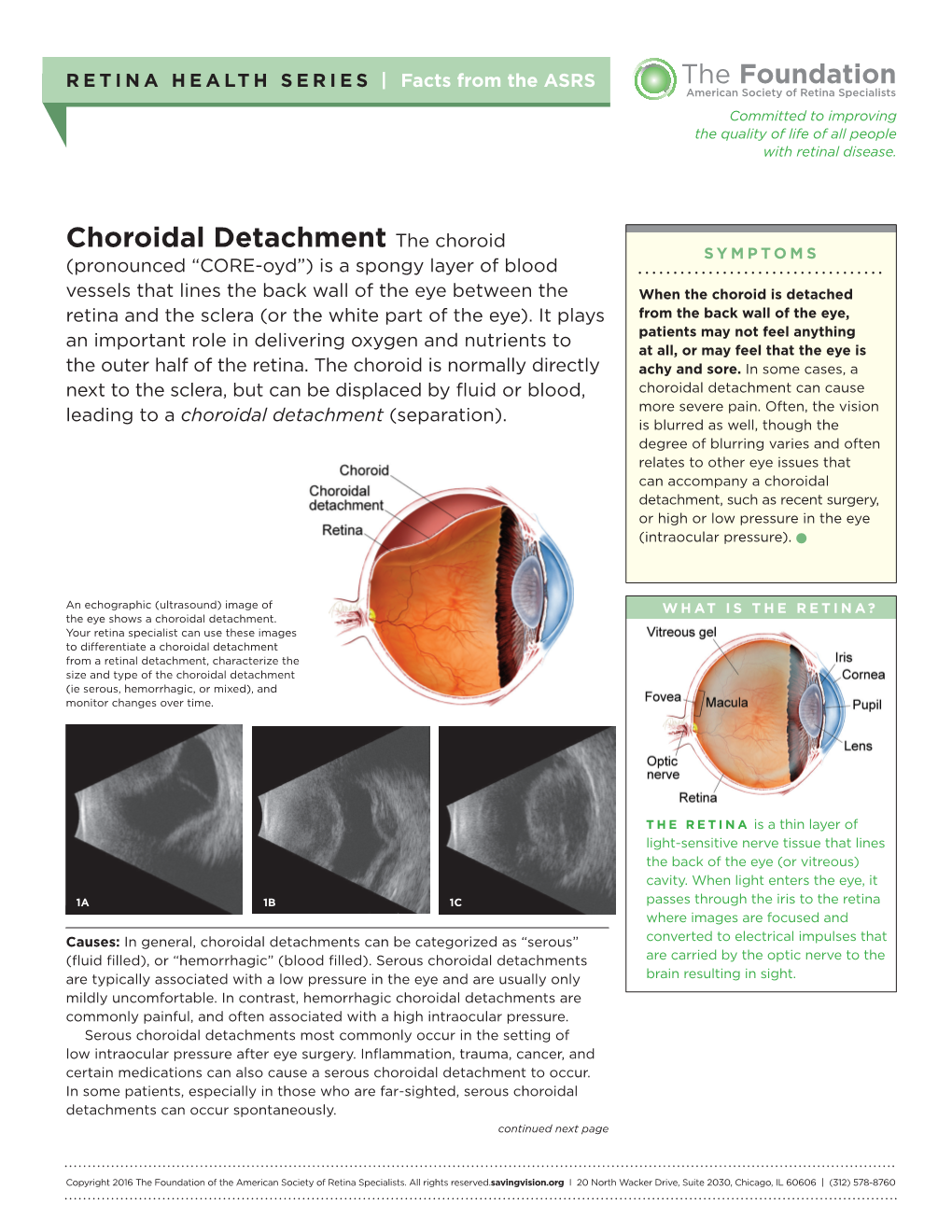 Choroidal Detachment