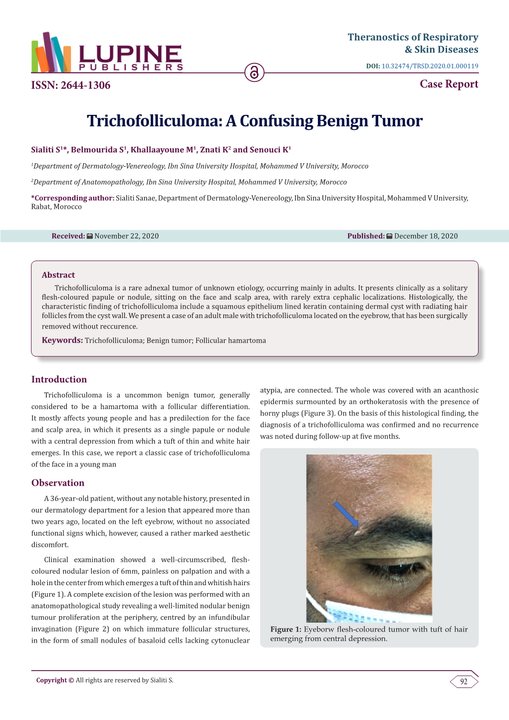 Trichofolliculoma: a Confusing Benign Tumor