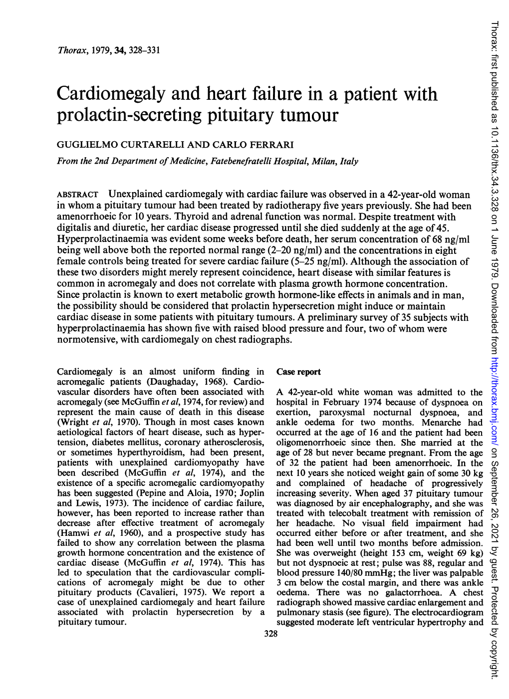 Cardiomegaly and Heart Failure in a Patient with Prolactin-Secreting Pituitary Tumour