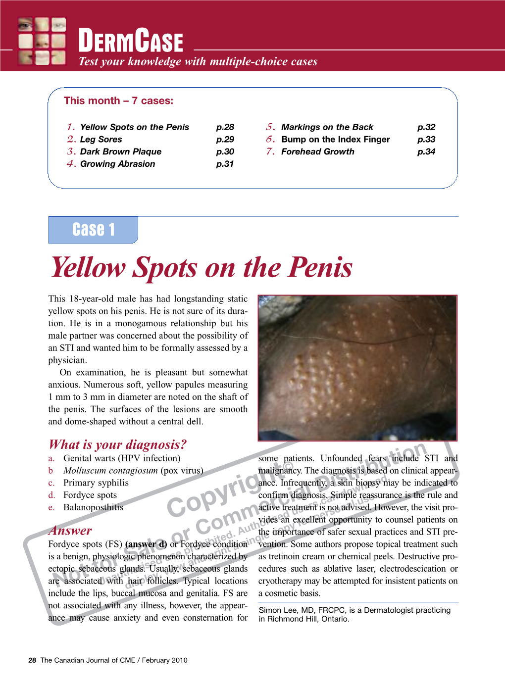 Yellow Spots on the Penis P.28 5
