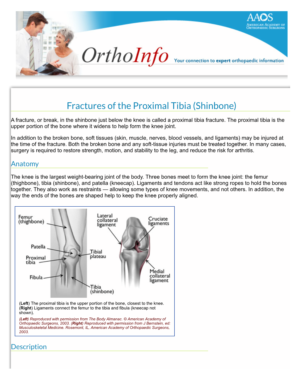 Fractures of the Proximal Tibia (Shinbone)