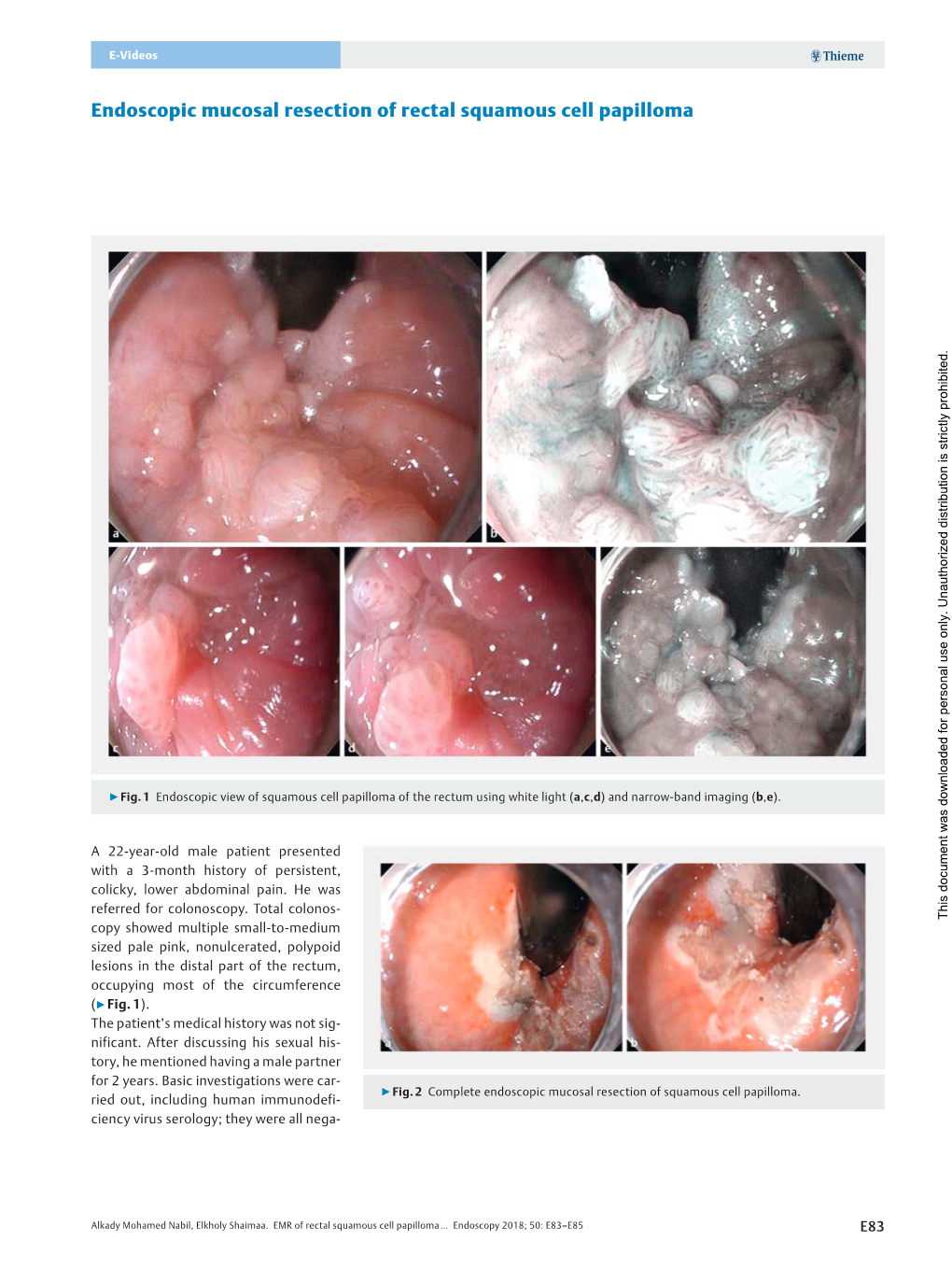Endoscopic Mucosal Resection of Rectal Squamous Cell Papilloma