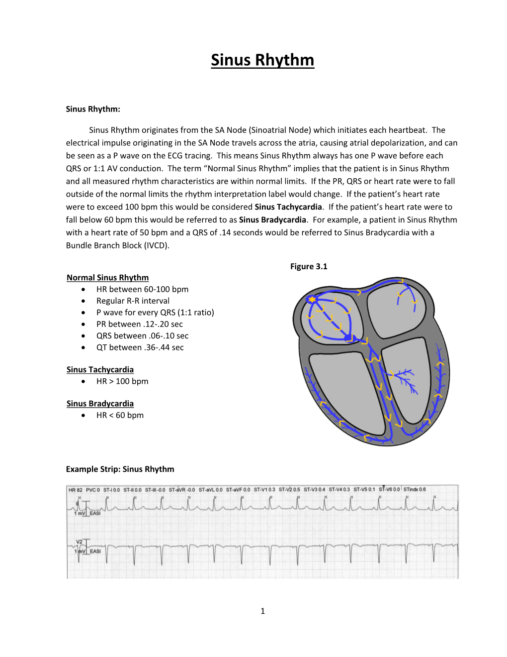 Sinus Rhythm