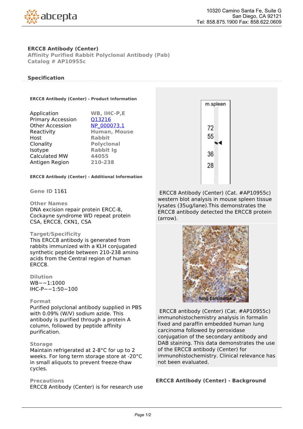 ERCC8 Antibody (Center) Affinity Purified Rabbit Polyclonal Antibody (Pab) Catalog # Ap10955c