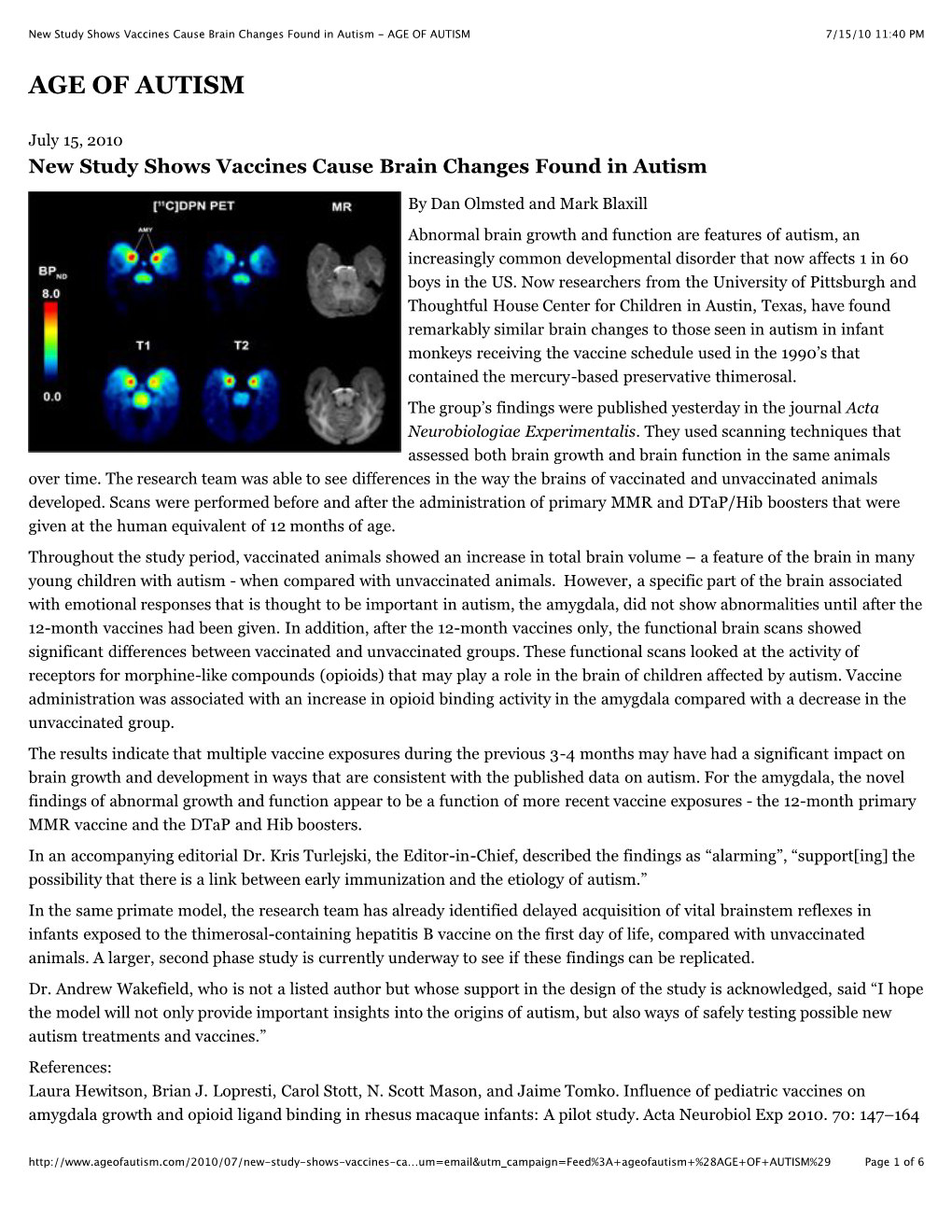 New Study Shows Vaccines Cause Brain Changes Found in Autism - AGE of AUTISM 7/15/10 11:40 PM