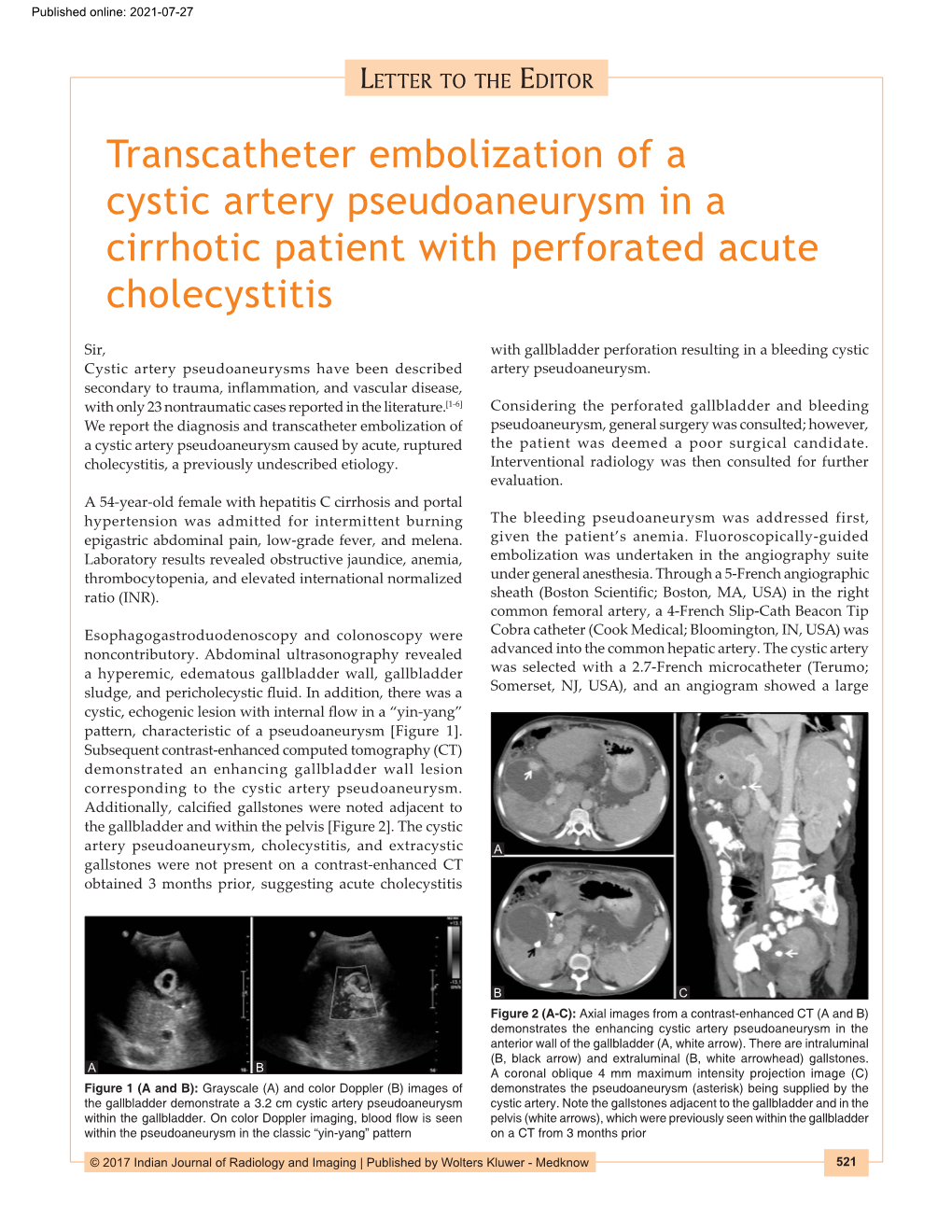 Transcatheter Embolization of a Cystic Artery Pseudoaneurysm in a Cirrhotic Patient with Perforated Acute Cholecystitis