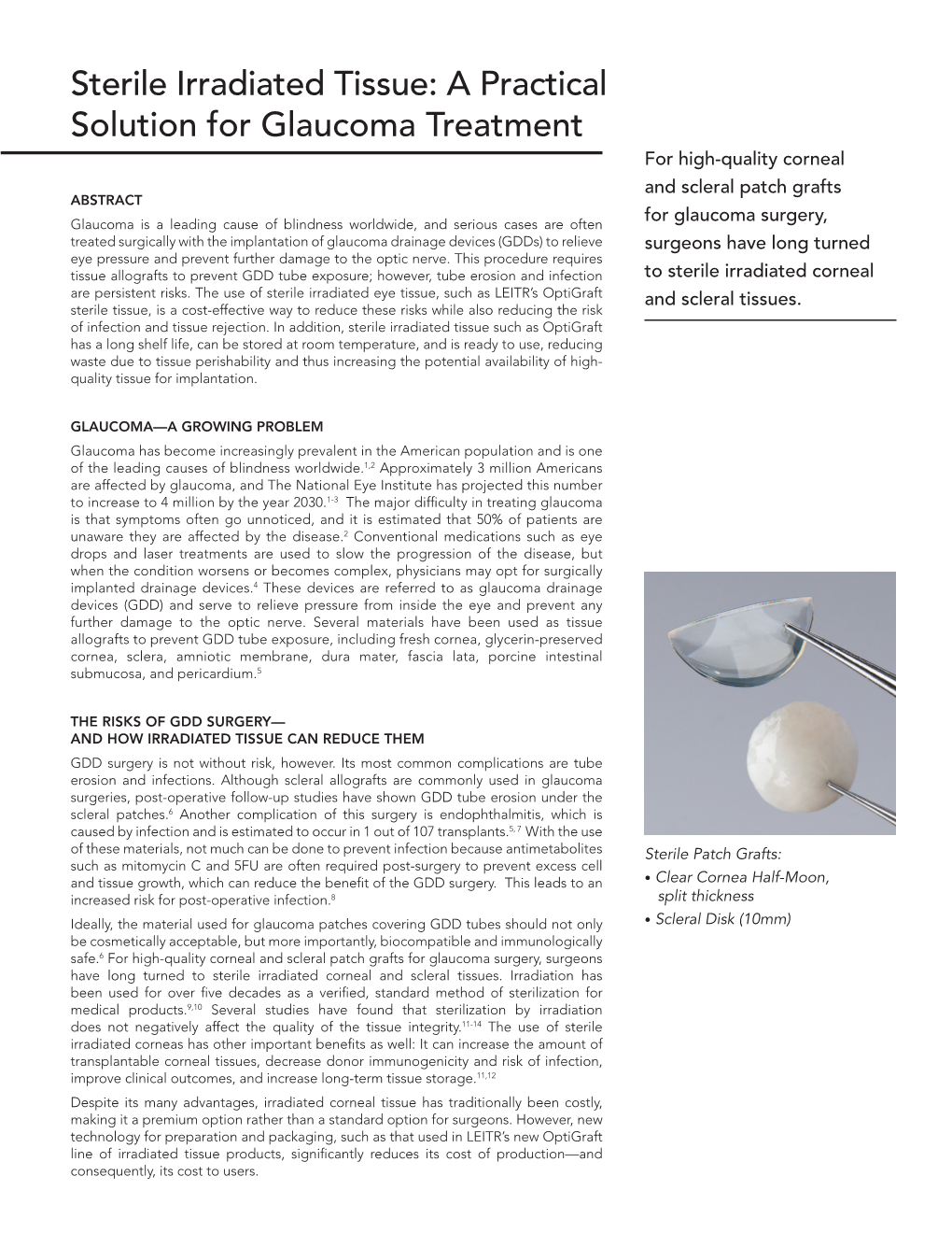 Sterile Irradiated Tissue: a Practical Solution for Glaucoma Treatment