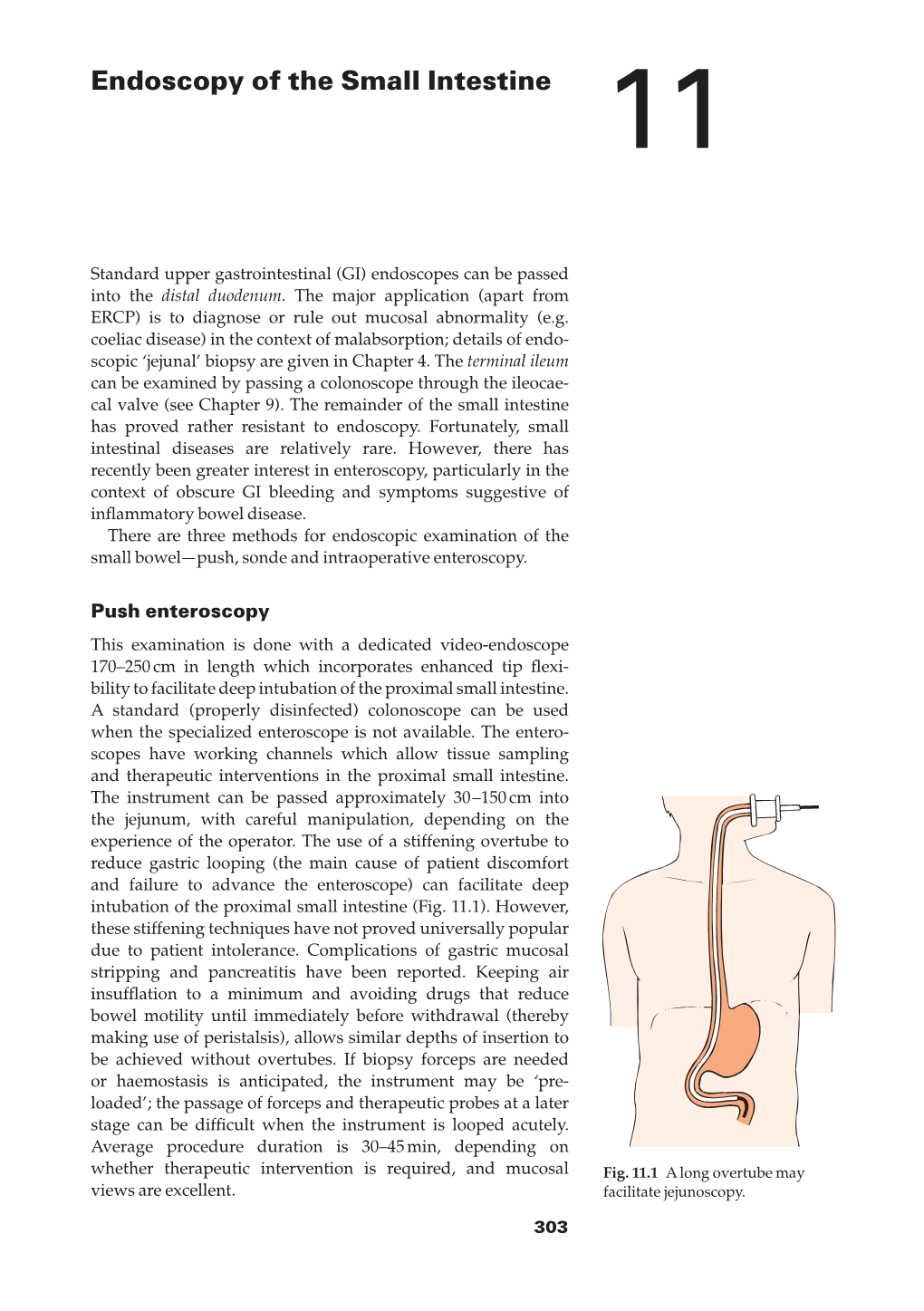 Endoscopy of the Small Intestine 11