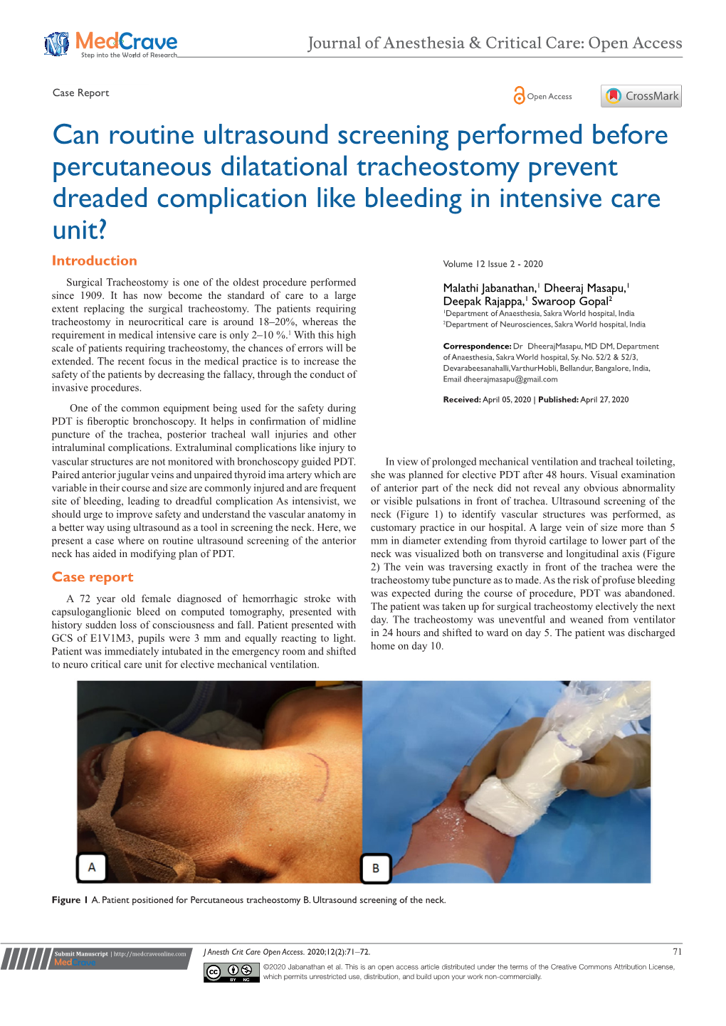 Can Routine Ultrasound Screening Performed Before Percutaneous Dilatational Tracheostomy Prevent Dreaded Complication Like Bleeding in Intensive Care Unit?