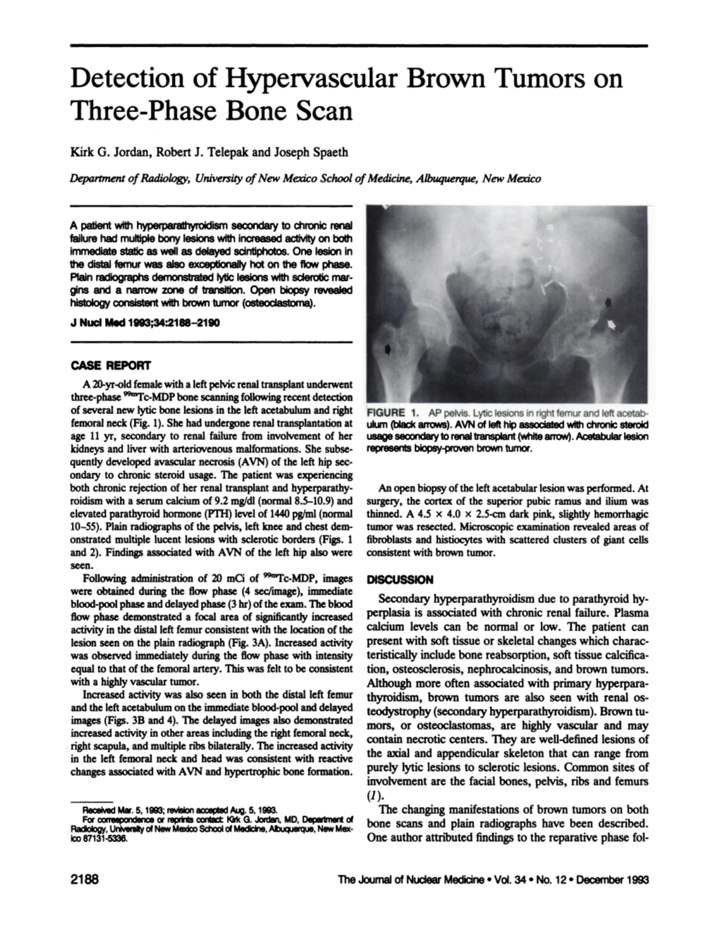 Detection of Hypervascular Brown Tumors on Three-Phase Bone Scan