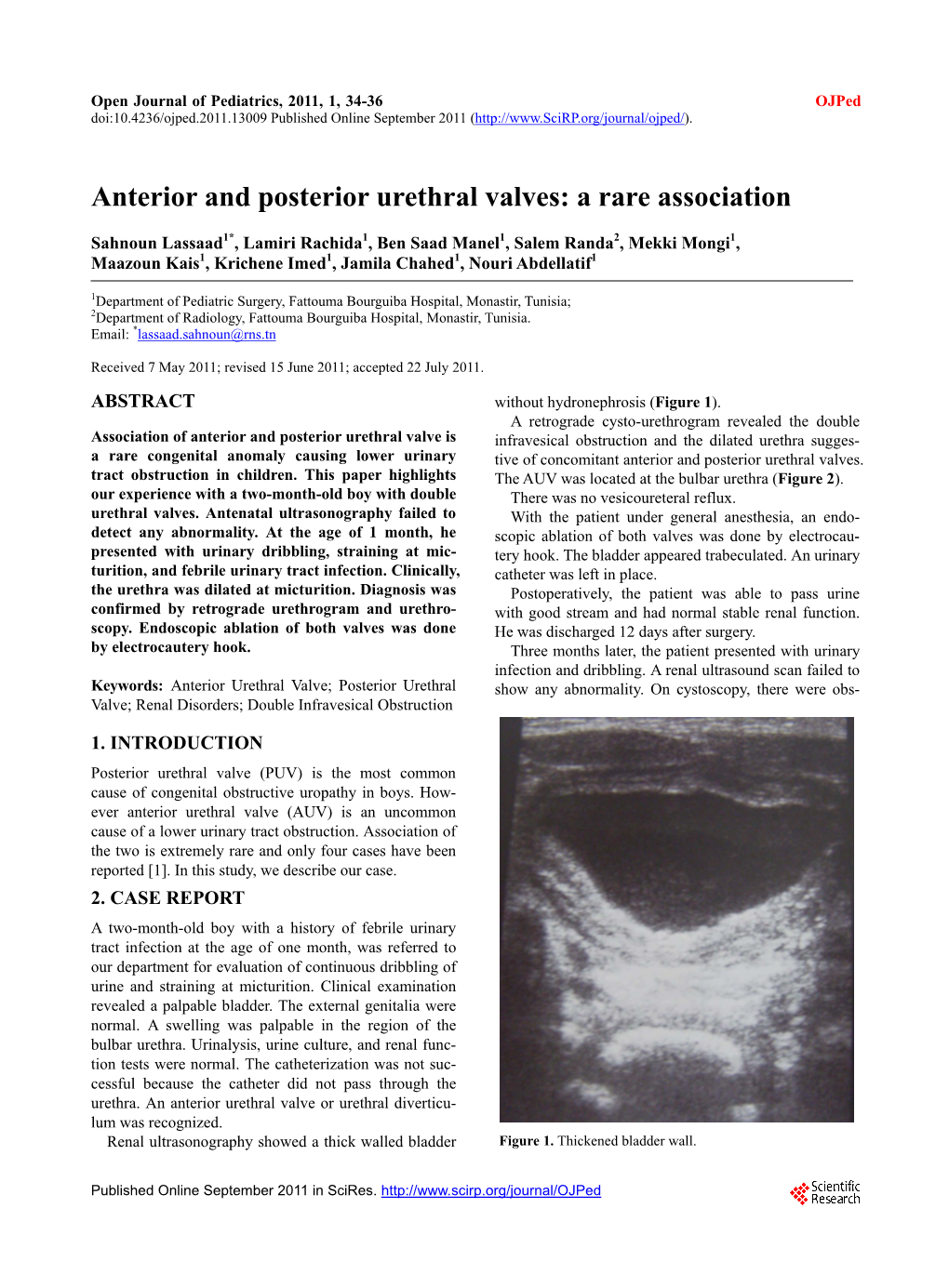 Anterior and Posterior Urethral Valves: a Rare Association