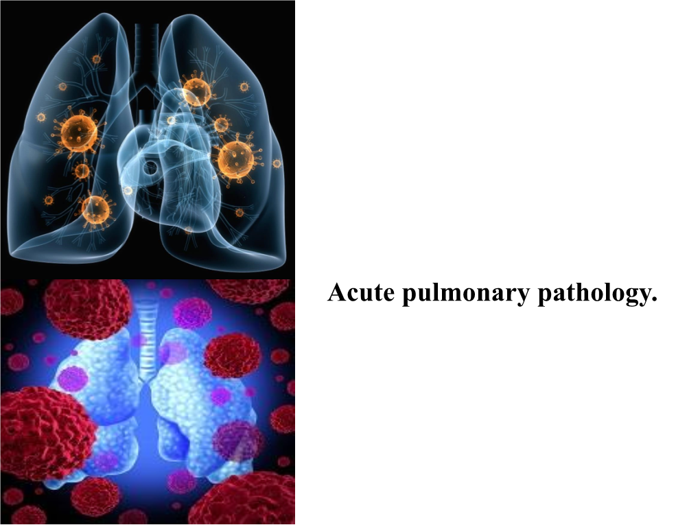 Acute Pulmonary Pathology. Acute Pulmonary Pathology