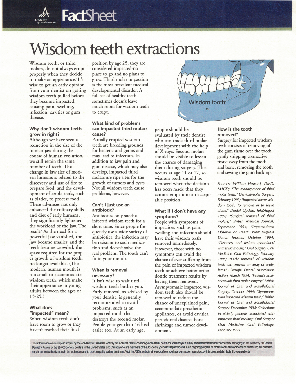 Wisdom Teeth Extractions