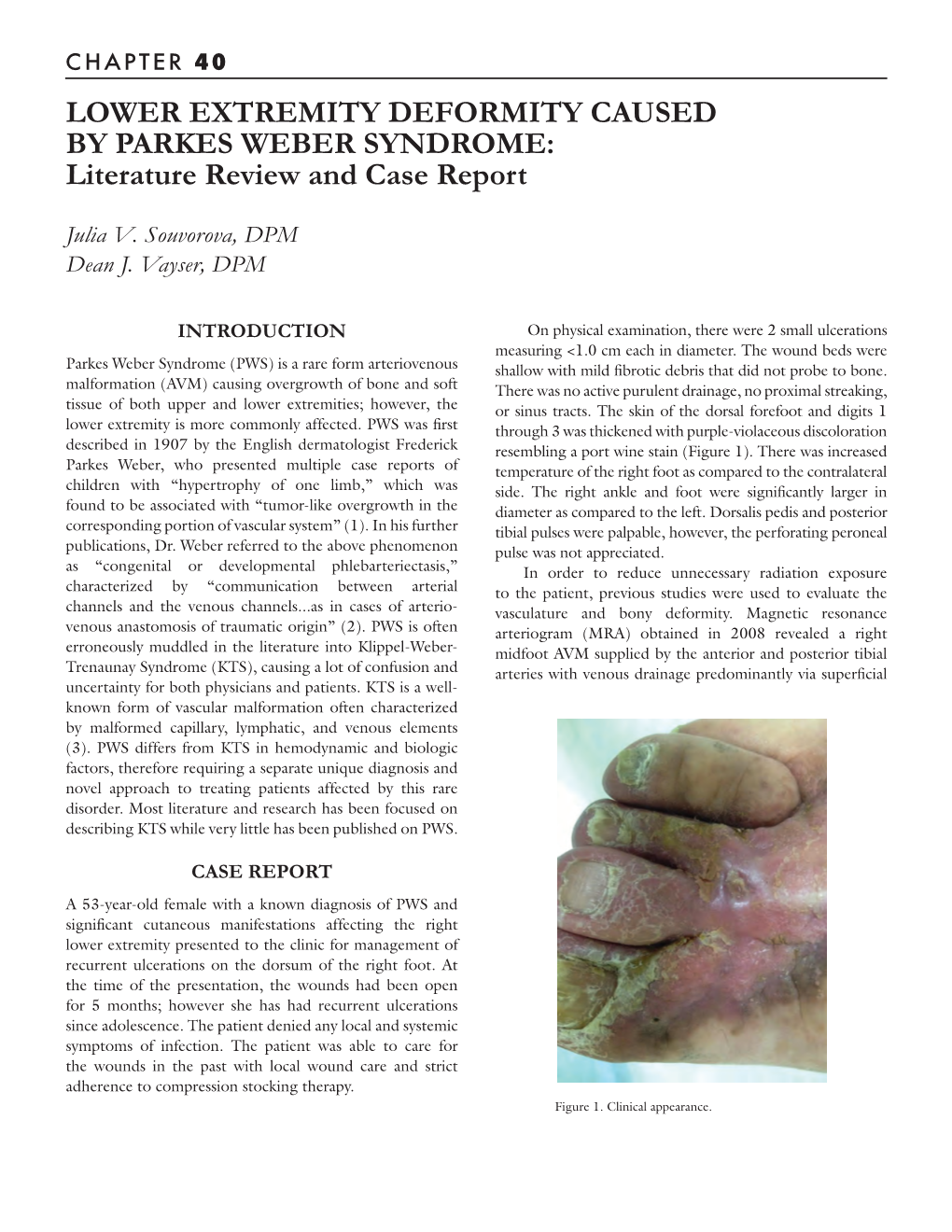 LOWER EXTREMITY DEFORMITY CAUSED by PARKES WEBER SYNDROME: Literature Review and Case Report