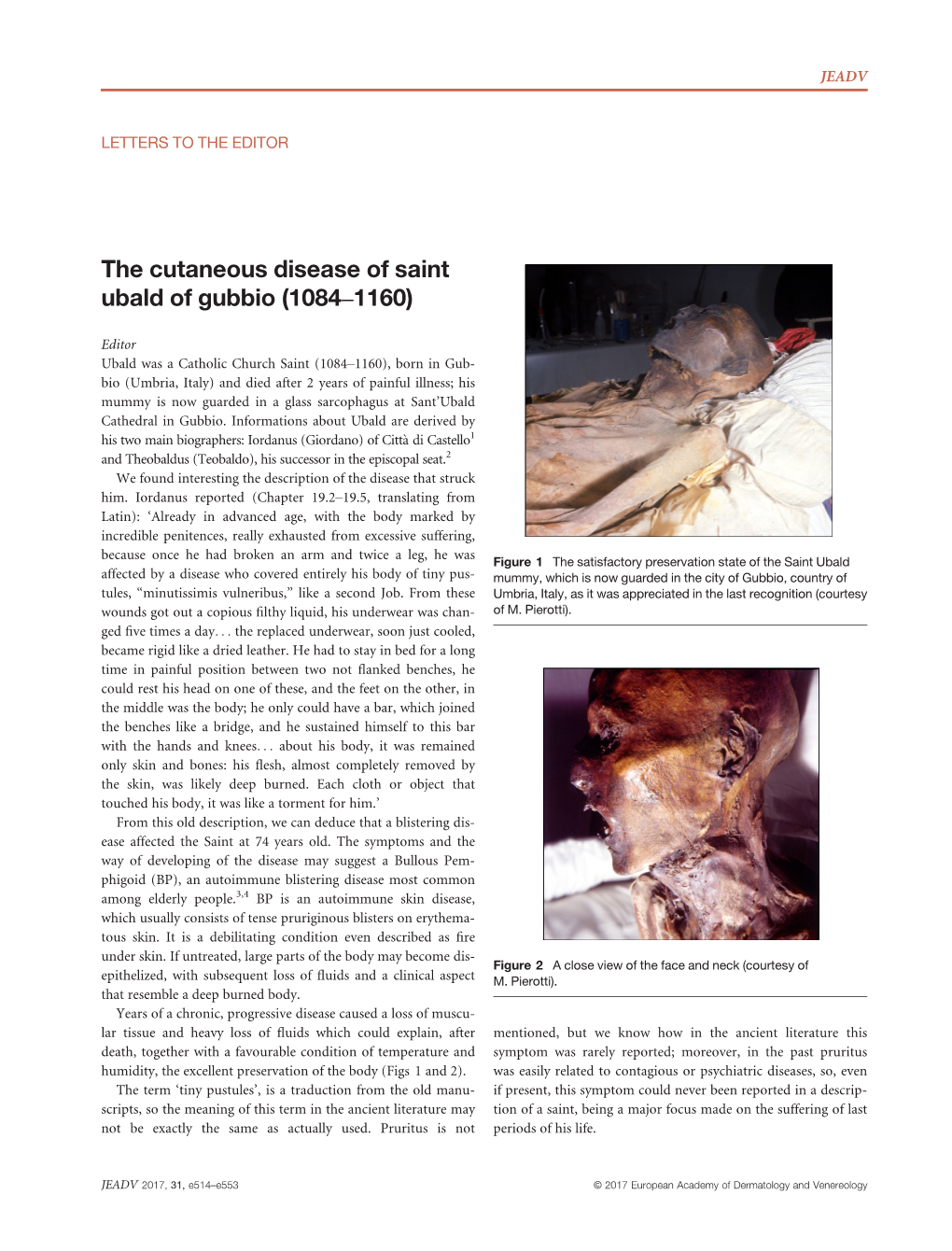 The Cutaneous Disease of Saint Ubald of Gubbio (1084&#X2013;1160)