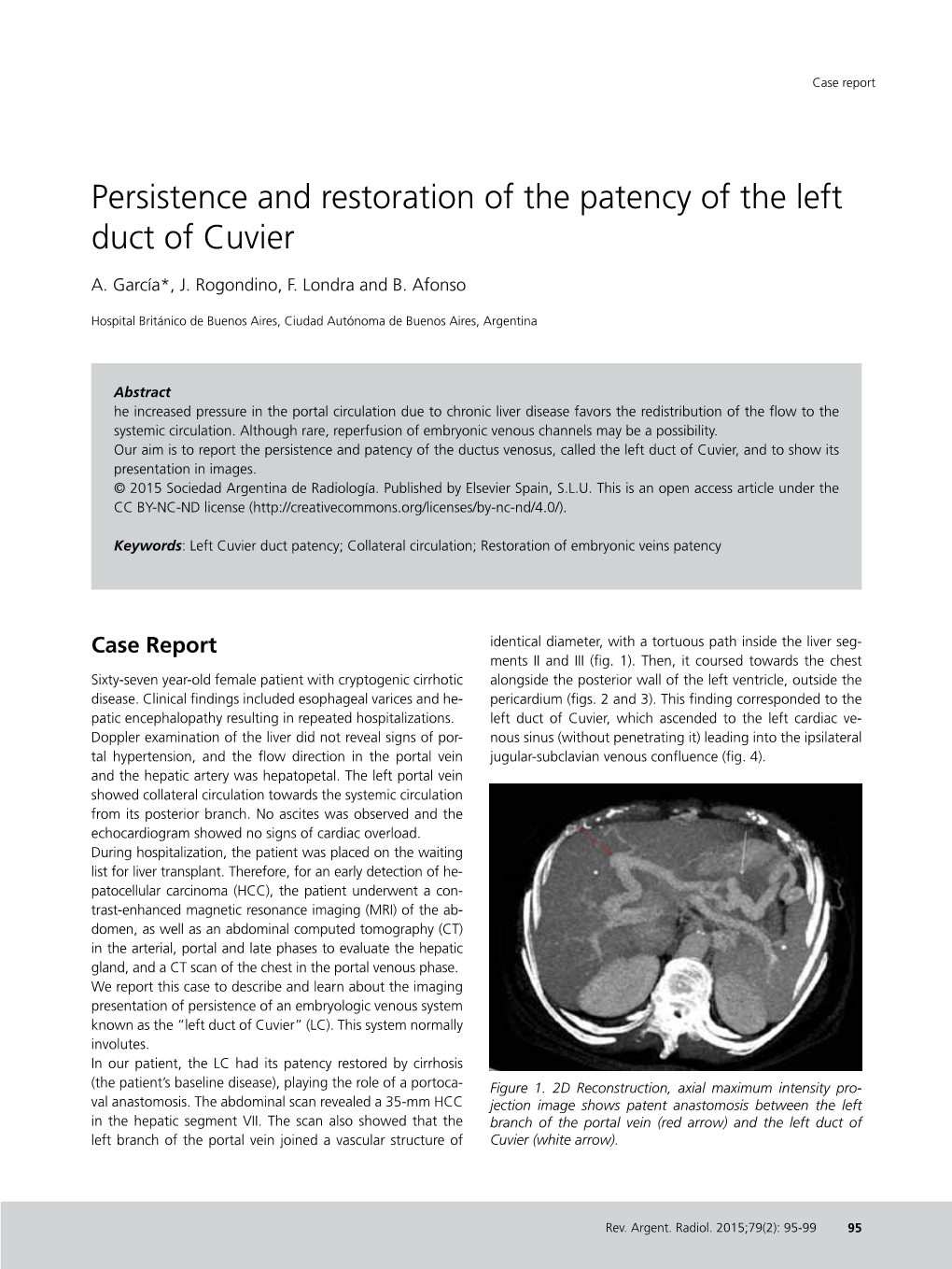 Persistence and Restoration of the Patency of the Left Duct of Cuvier