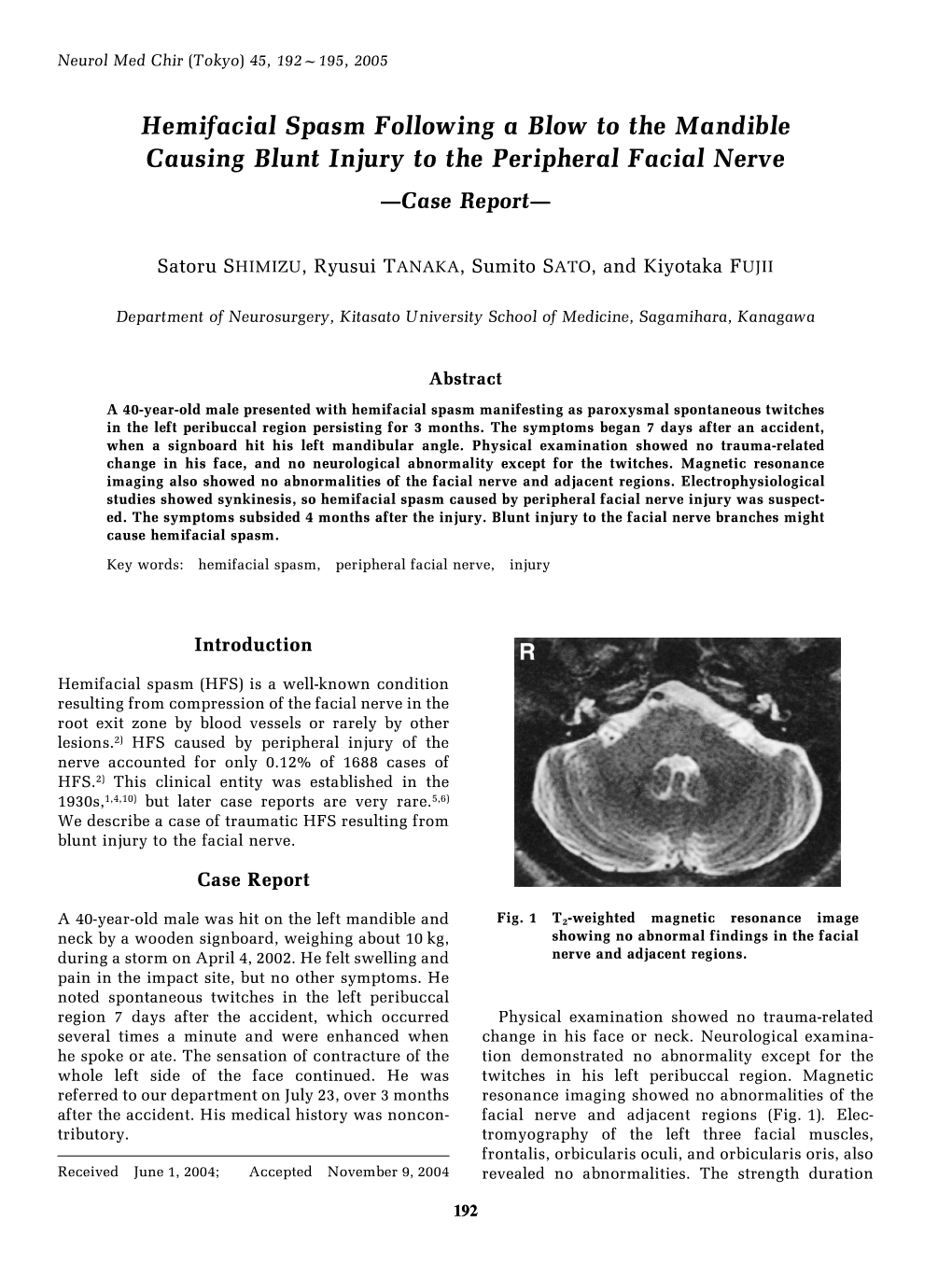 Hemifacial Spasm Following a Blow to the Mandible Causing Blunt Injury to the Peripheral Facial Nerve —Case Report—