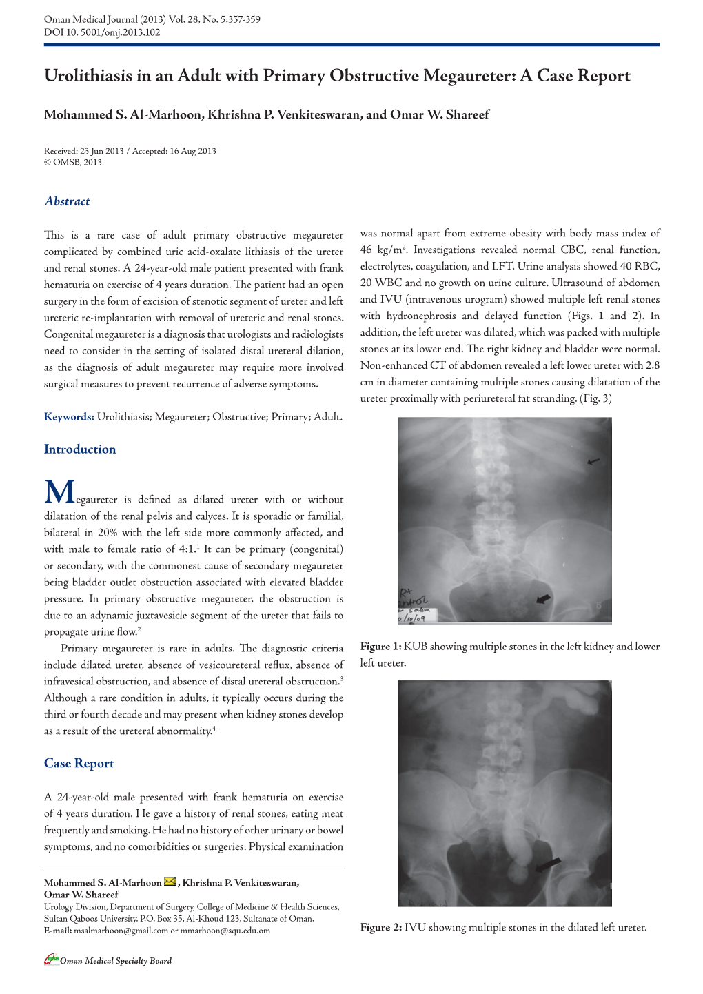 Urolithiasis in an Adult with Primary Obstructive Megaureter: a Case Report